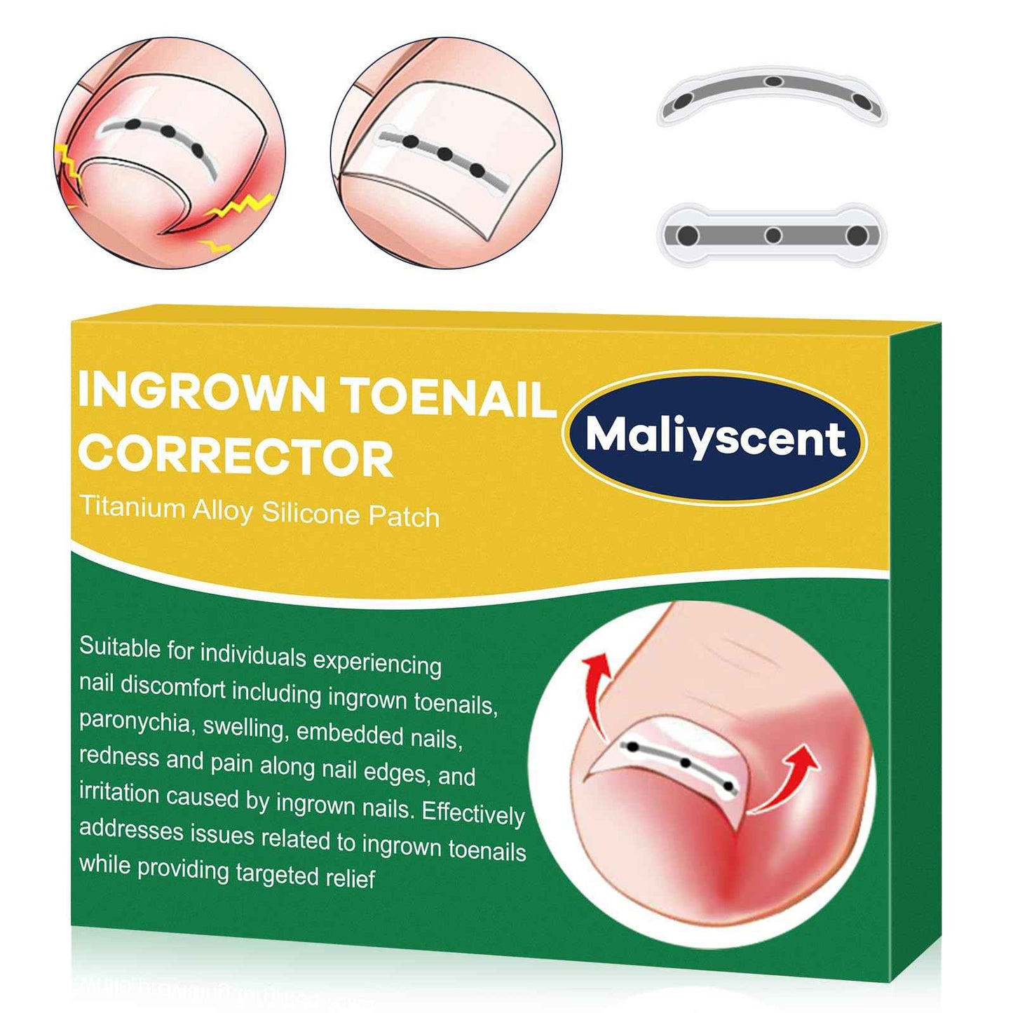 Titanium Alloy Ingrown Toenail Corrector New Version Ingrown Toenail Removal Tool Kit, Designed for Curved Nail Repair Big Toe Ingrown Toenail