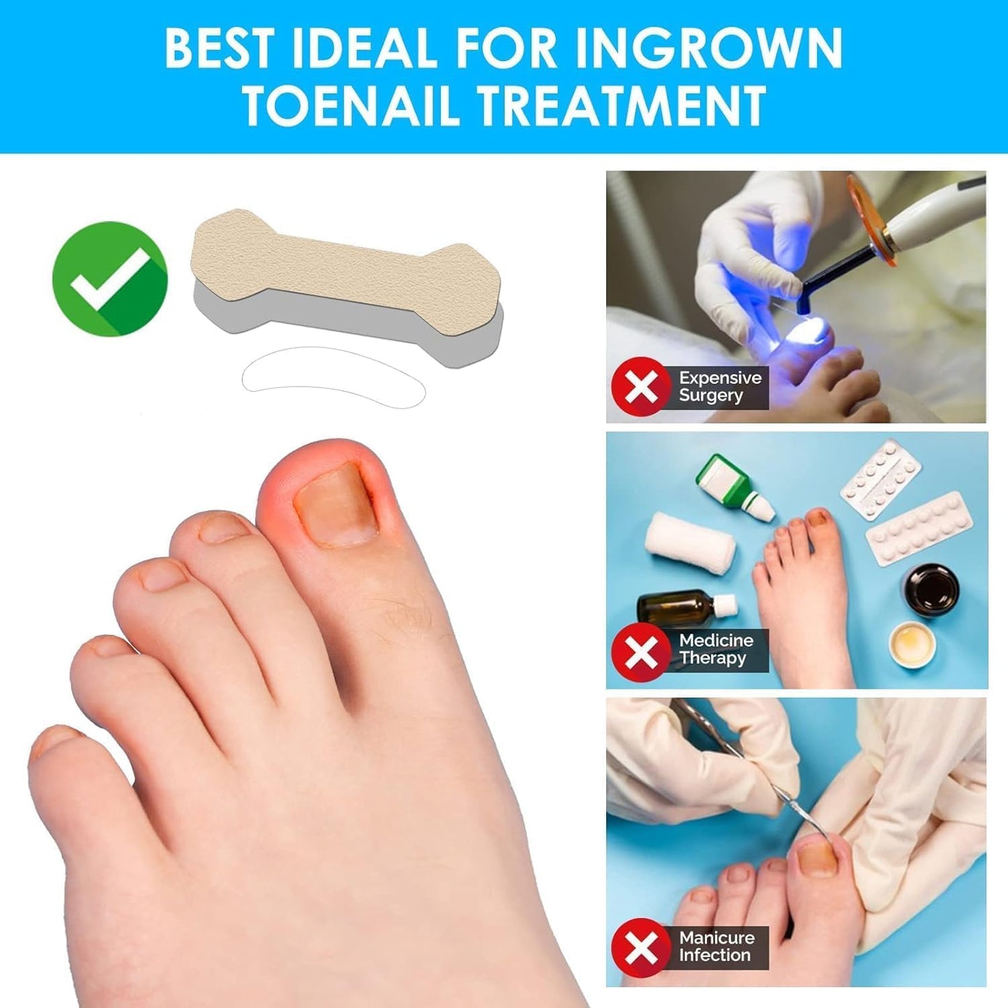 Ingrown Toenail Treatment, 60Pcs Breathable Ingrown Toenail Strips,Painless Ingrown Toenail Tool, Professional Pedicure for Ingrown Toenail, Brown