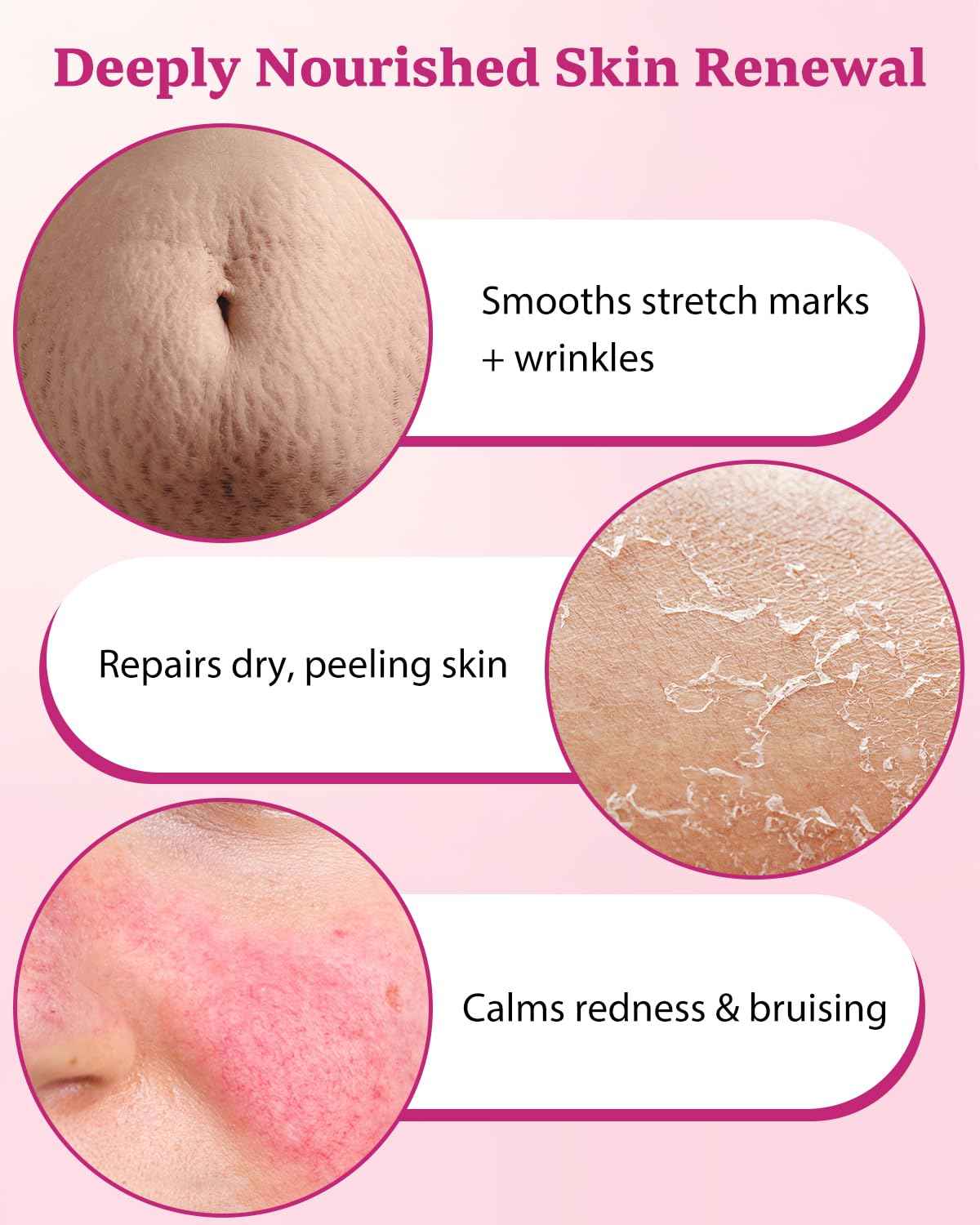 XUEBEIK Helichrysum Multipurpose Balm - Natural Soothing Hydrating Salve with Helichrysum Oil for Thin, Fragile, B-ruised & Aging Skin | Moisturizes & Revitalizes Body & Face - 60G/2OZ