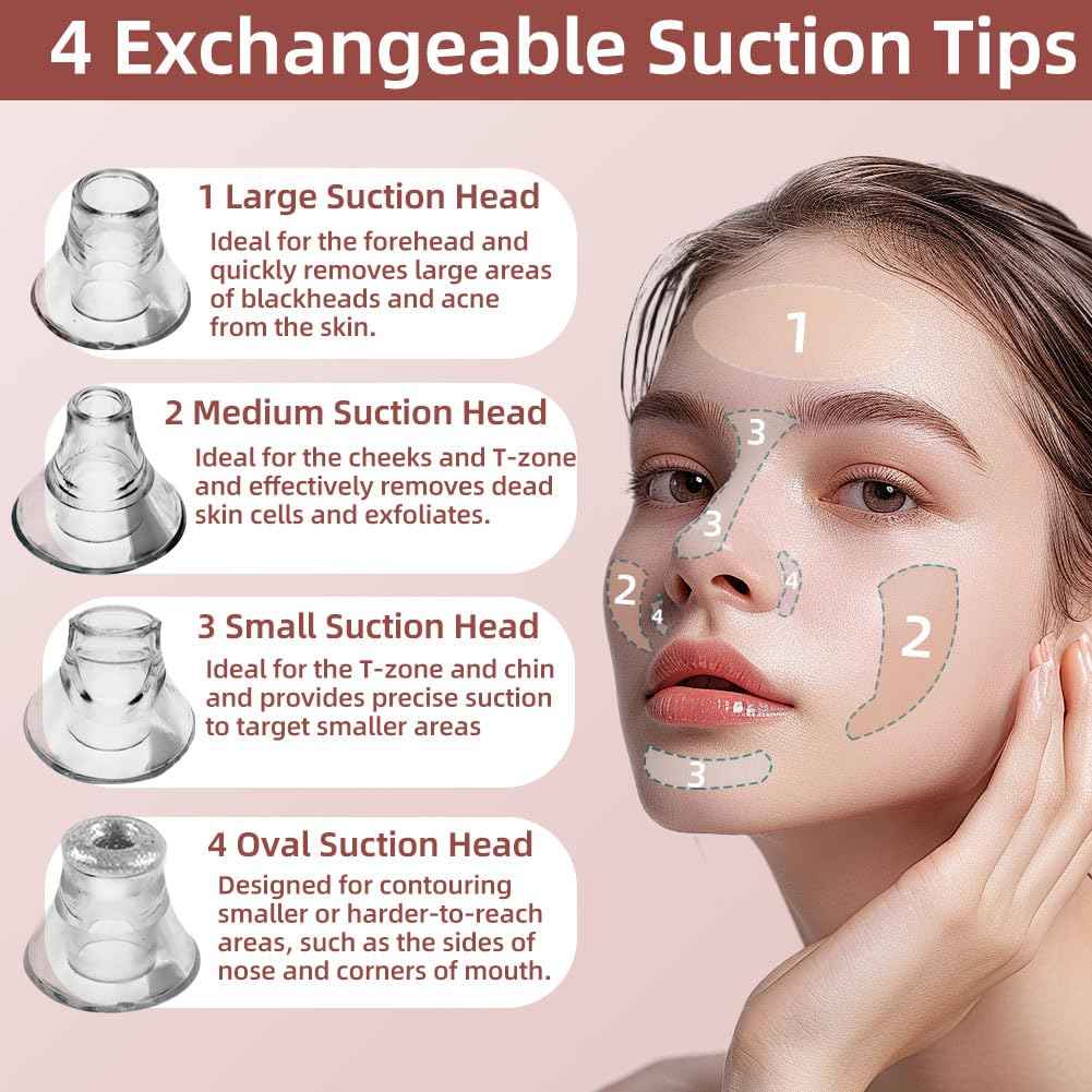 5-Speed Blackhead Remover Vacuum, Wireless Charging Nose Pore Extractor with 4 Removable Heads,Facial Vacuum Pore Cleaner,30-Second Keratin Softening, Hypoallergenic Deep Cleansing