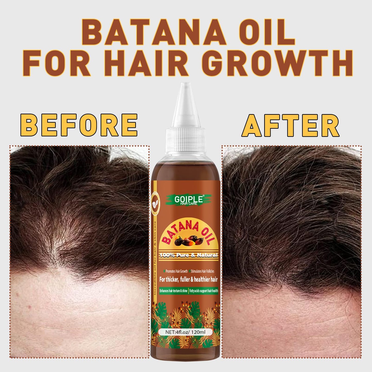 100% Pure Batana Oil for Hair Growth Organic Hair Growth Oil Hair oil Natural Raw Batana Oil for Hair Growth & Thicker & Stronger Hair (1pc batana oil)