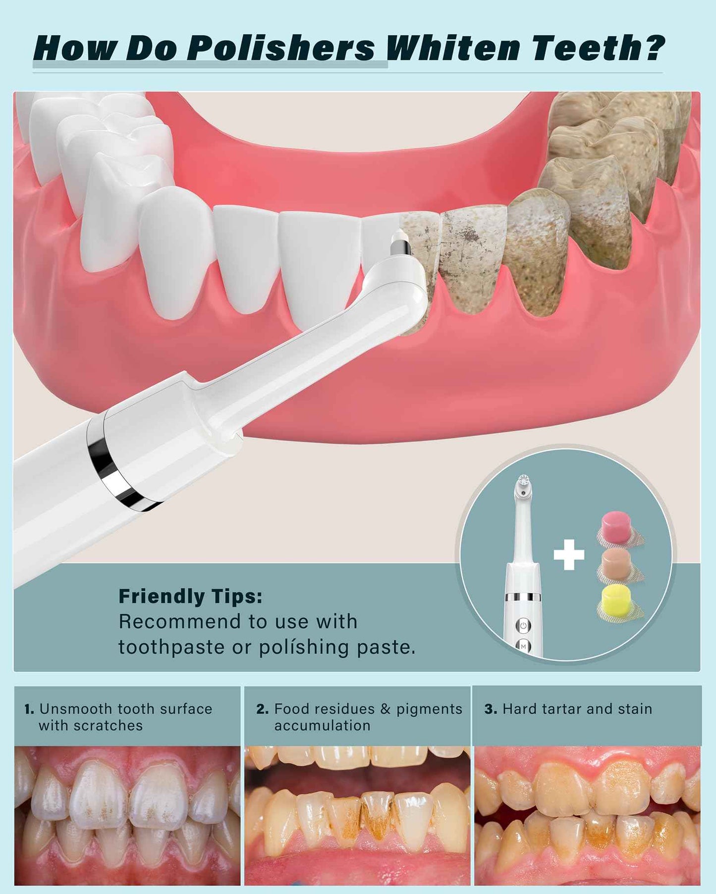 Tooth Polisher, Rechargeable Tooth Whitening Kit for Teeth Cleaning and Whitening, with 3 Tooth Polish Paste and 5 Brush Heads, LED Light, Easy to Use at-Home Personal Dental Care Kit