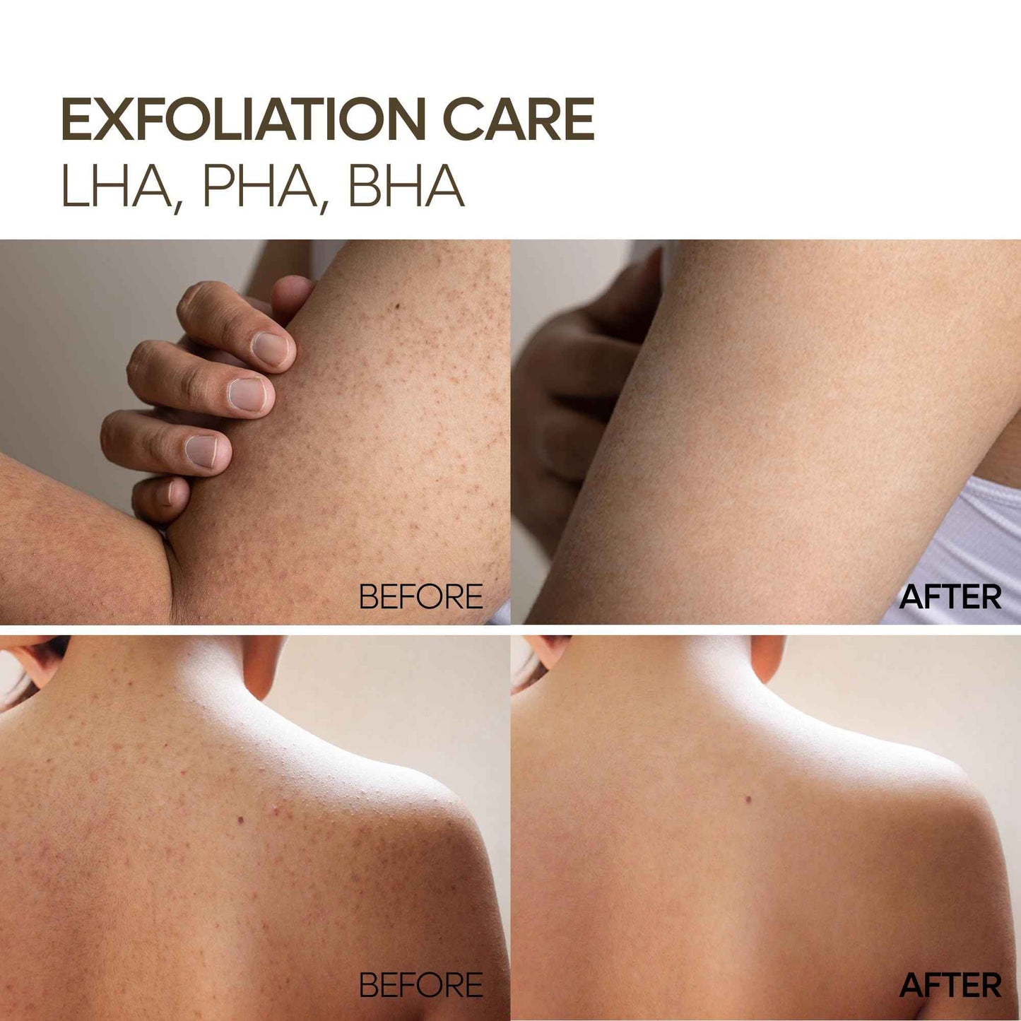 Dr.Melaxin Guerande Sea Salt Perfume Exfoliating Body Scrub for Smooth Skin Body, Amber & Vanilla Scent