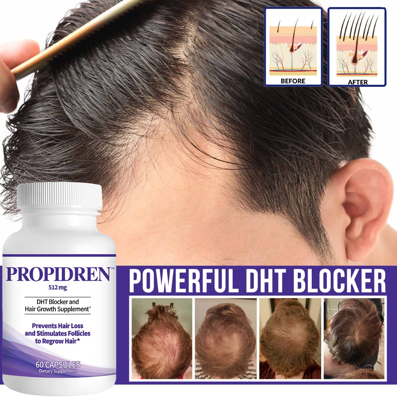 Propidren by HairGenics - DHT Blocker & Hair Growth Capsules to Prevent Hair Loss & Stimulate Hair Follicles, to Stop Hair Loss & Regrow Hair. Proprietary Anti-Hair Loss & Hair Regrowth Treatment.