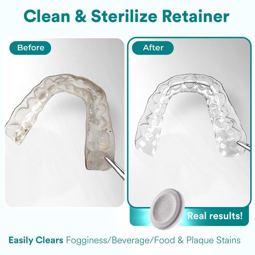 Retainer Cleaner Tablets, Invisalign Cleaner, Remove Stains, Odors & Plaque, Night Guard Cleaner, FSA & HSA Eligible, 4-Month Supply of PERSULFATE-Free Denture Cleaner, 120 Tablets, Mint-Scented
