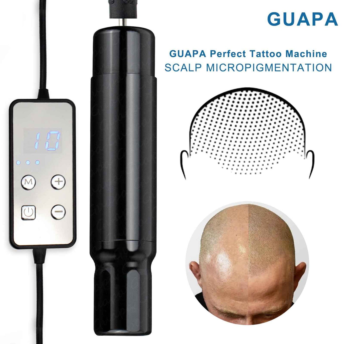 Scalp Micropigmentation Machine Kit – Professional SMP Hair Tattoo Machine with Adjustable Needles for Hairline Restoration