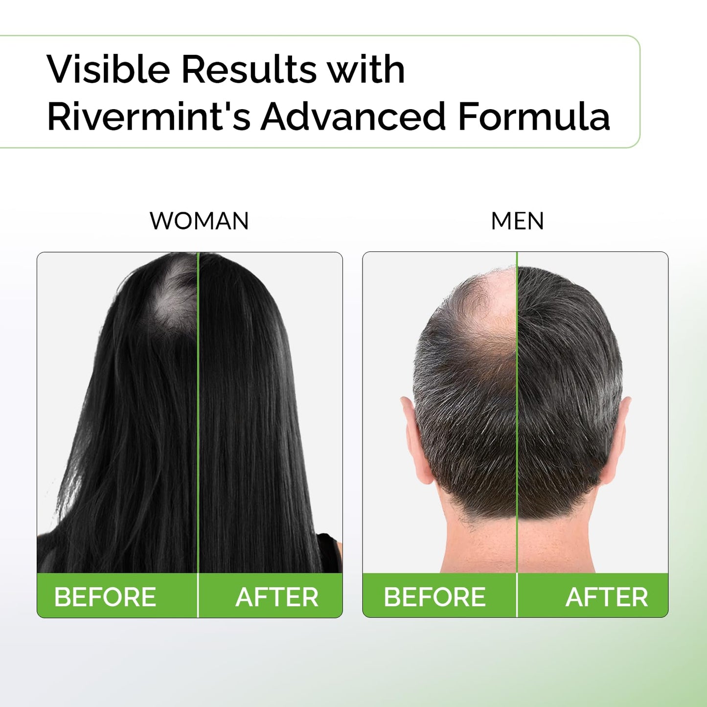 Rivermint Shampoo with Minoxidil and Biotin: Hair Growth Stimulant for Men and Women, anti hair loss - Made in the USA