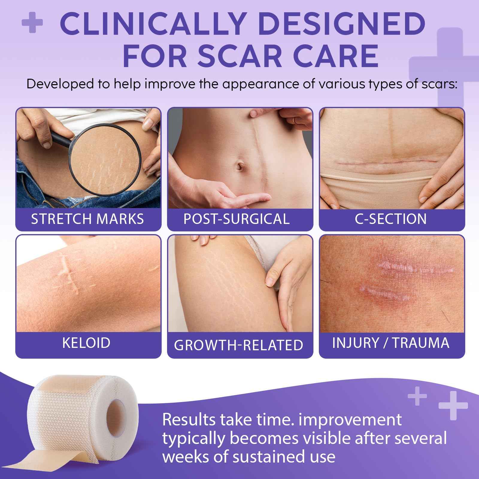 Silicone Scar Sheets, Silicone Scar Tape (1.6” x 60” Roll, 1.5M) – Reusable Silicone Scar Sheets for Surgical Scars, C-Section, Keloids, Burns, Acne, and Keloid Bump Removal