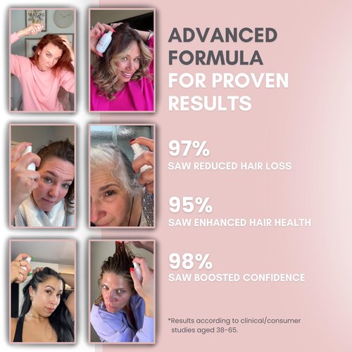 Zephta H-Regrow 2.0 Hair Growth Serum for Women & Men – Biotin & Caffeine Spray for Thicker Hair – 1.7 Fl Oz – Hair Growth Spray for Thinning Hair