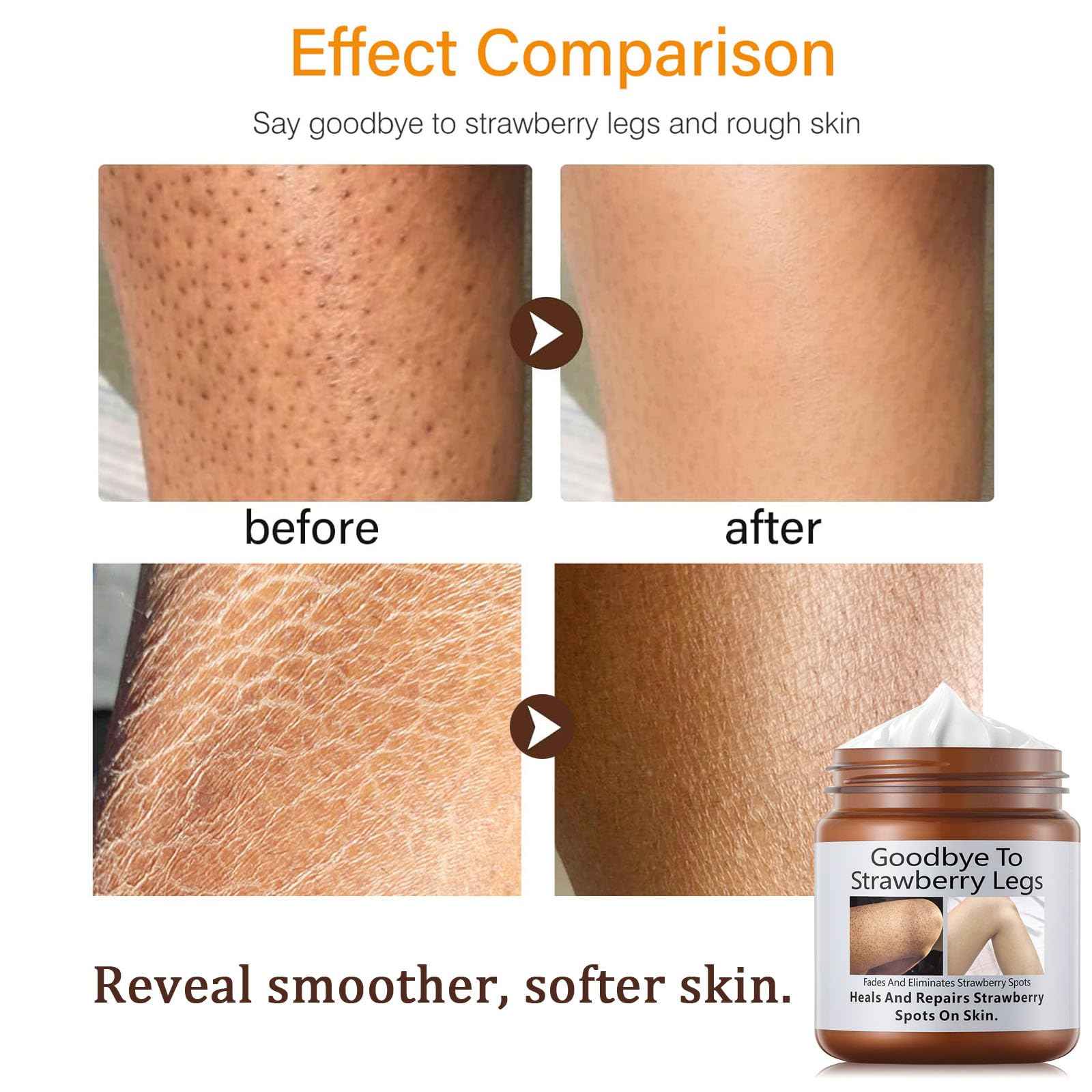 Strawberry Skin Treatment– Strawberry Legs Resurfacing Cream, Ultra Strength Exfoliating Body Lotion for Rough & Bumpy Skin, Body Care moisturizer for Women (2)