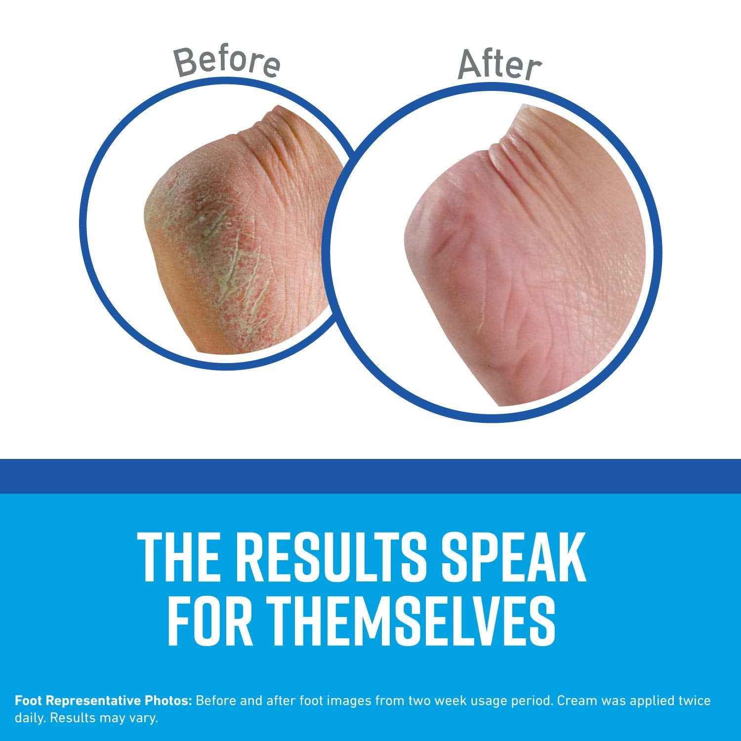 O'Keeffe's Winter Essentials Including Working Hands, Healthy Feet and Skin Repair