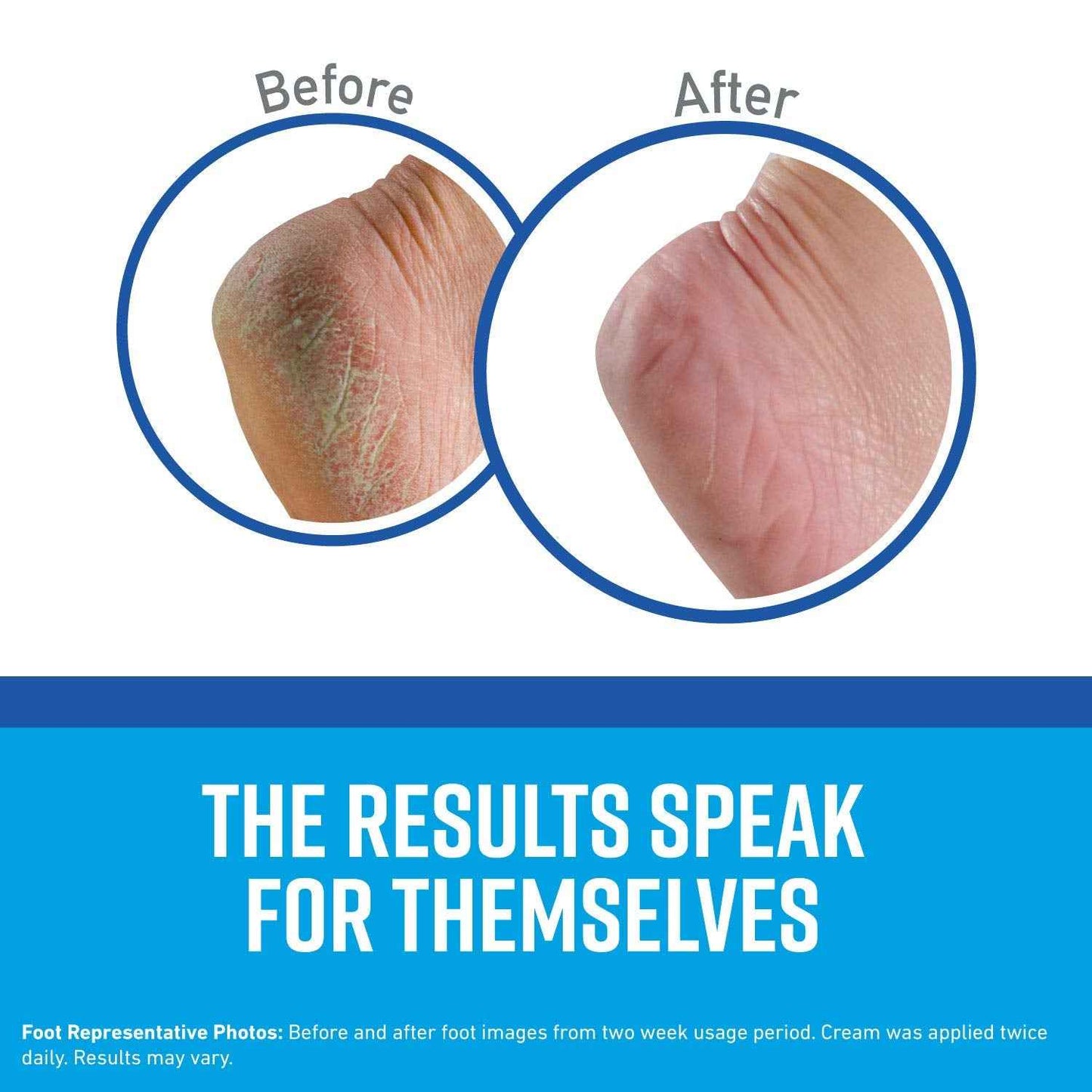 O'Keeffe's K0280004-3 Healthy Feet Foot Cream Tube (3 Pack), 3 oz