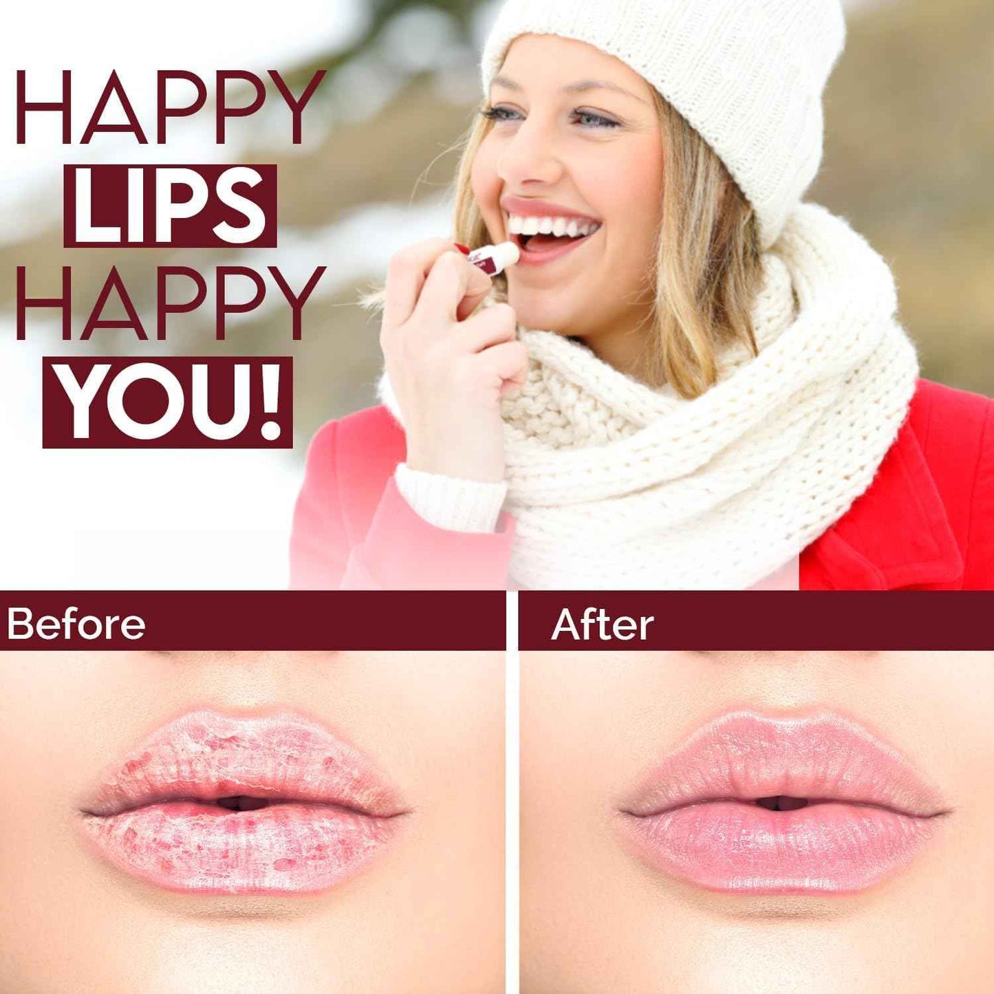 Natural Solution Lip Balm, Formulated with Cherry & Organic Shea Butter, Moisturizing Lip Care Multipack, Hydrating Moisturizer for Dry Lips, Organic Chapstick- 3 Count,6 Pieces