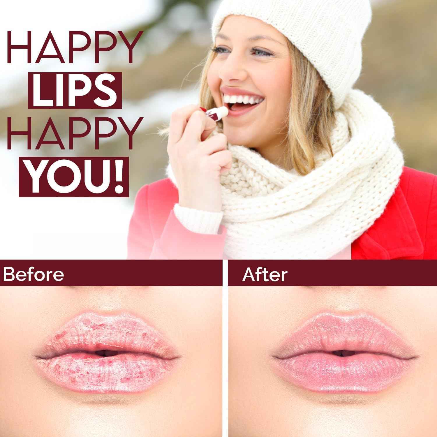 Natural Solution Lip Balm, Formulated with Cherry & Organic Shea Butter, Moisturizing Lip Care Multipack, Hydrating Moisturizer for Dry Lips, Organic Chapstick- 3 Count,6 Pieces