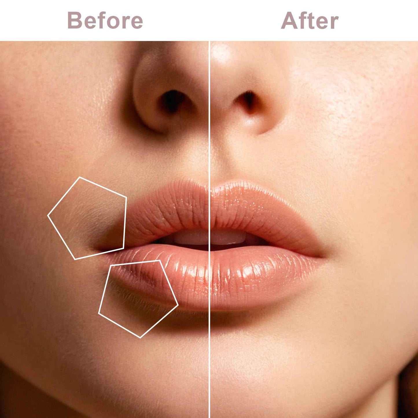 Facial Hair Remover for Women, Face Shaver for Women, Lady Face Electric Razor for Lip, Chin, Peach Fuzz, 2 Replacement Heads and USB Rechargeable