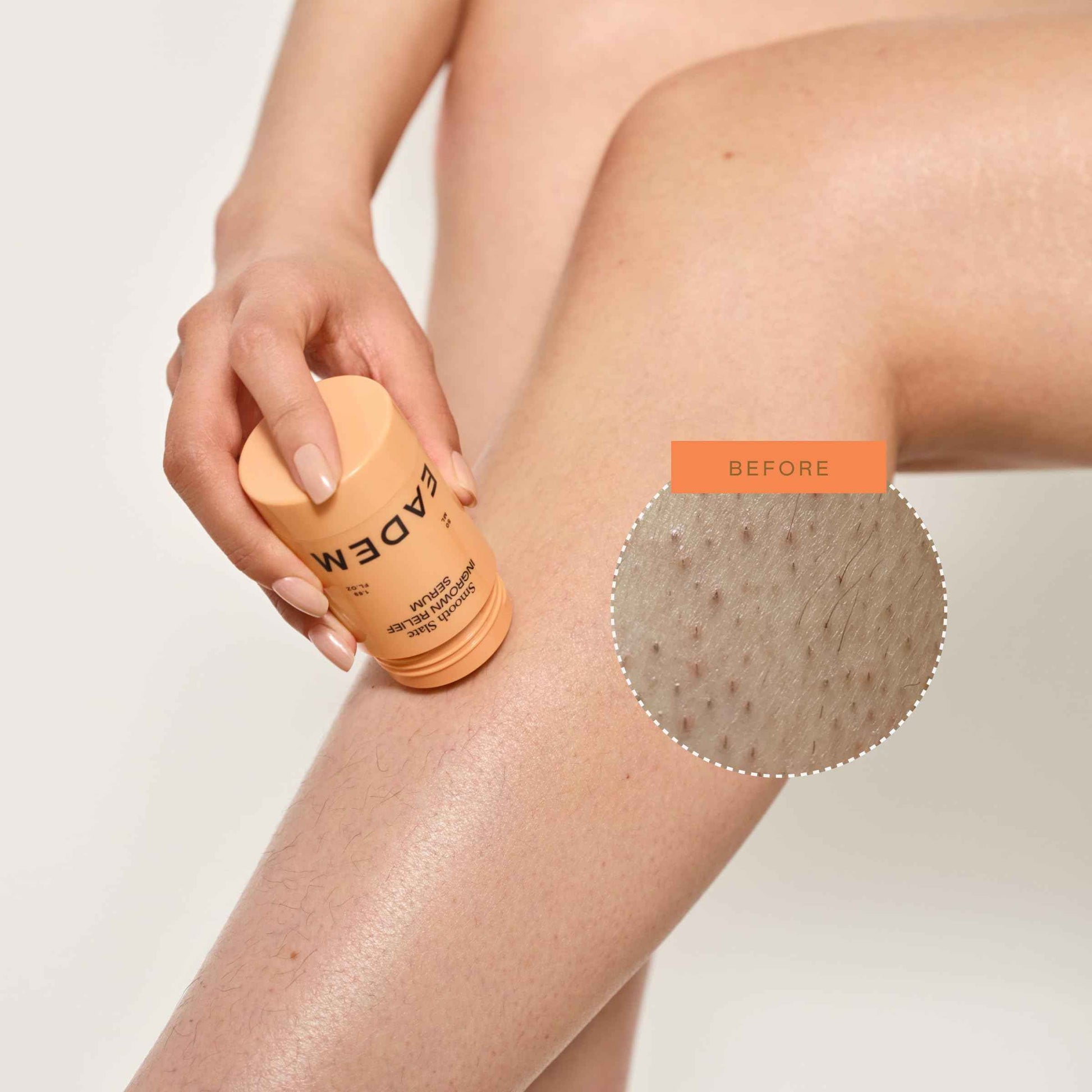 EADEM Smooth Slate Ingrown Hair Roller Serum, Targets Bumps Trapped Hairs, Faded Topicals for Scarring and Dark Spots, AHAs and Tyrosinase, Slows Ingrown Hair Regrowth