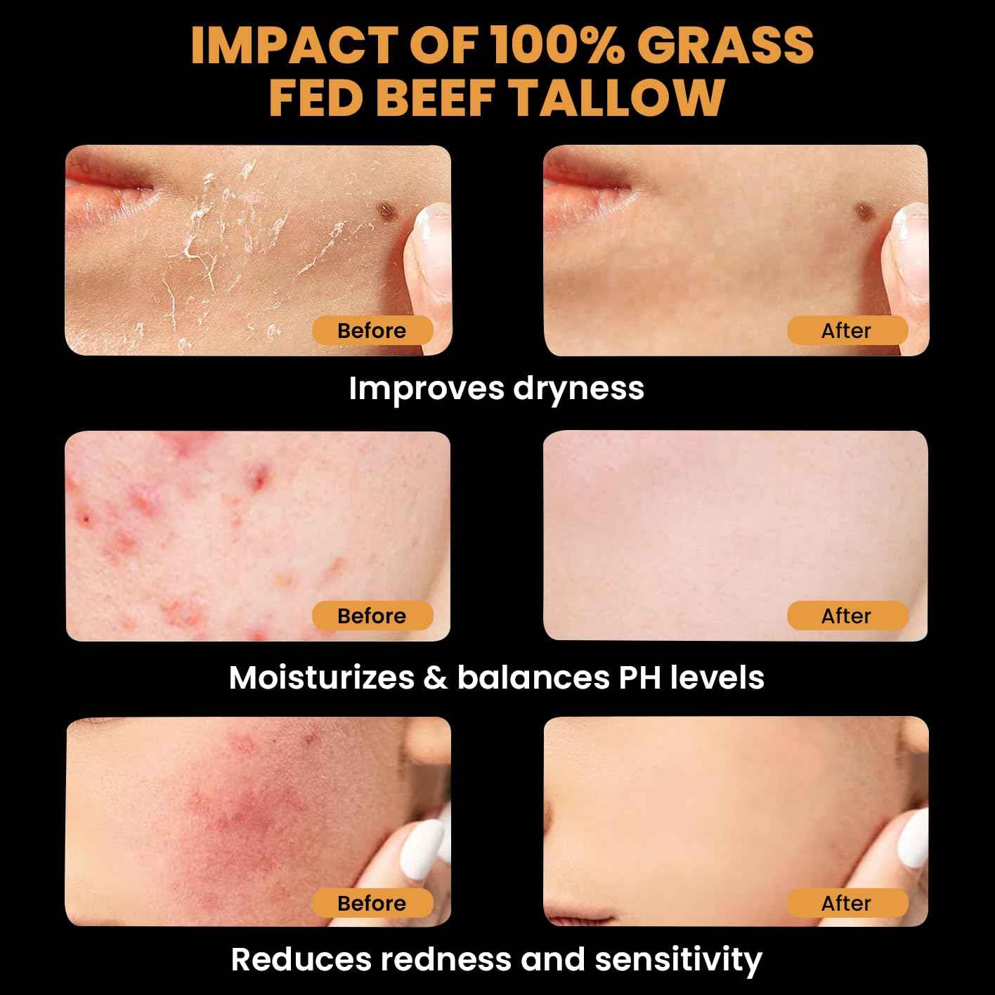 MONIER Tallow and Honey Balm for Face, Beef Tallow for Skin, Moisturizer with 100% Organic Grass-Fed Beef Tallow & Raw Wild Honey - Natural Formula for Dry & Sensitive Skin (Unscented - 2 Pack)