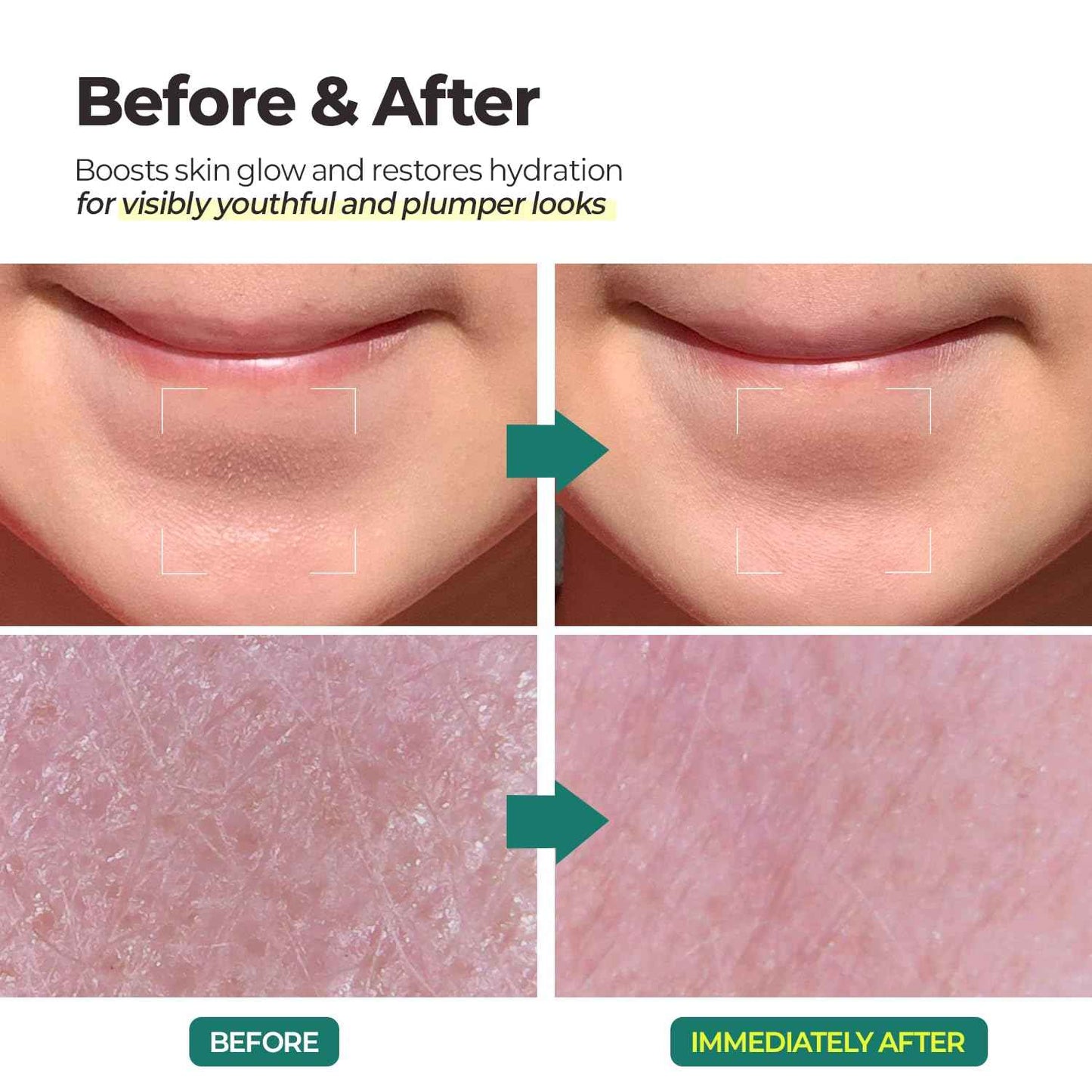 MOTHER MADE LHA Green Tea Exfoliating Aqua Peel Gel, Deep Pore Face Exfoliant, Gentle Facial Exfoliator, Dead Skin Remover, Natural Cellulose for Peeling, Vegan, Korean Skincare (100ml / 3.38 fl.oz)