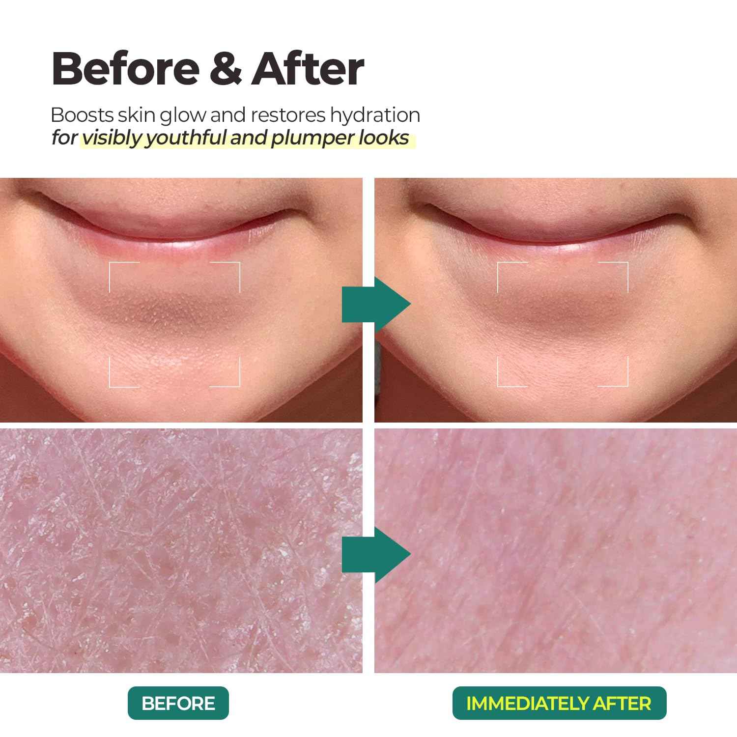 MOTHER MADE LHA Green Tea Exfoliating Aqua Peel Gel, Deep Pore Face Exfoliant, Gentle Facial Exfoliator, Dead Skin Remover, Natural Cellulose for Peeling, Vegan, Korean Skincare (100ml / 3.38 fl.oz)