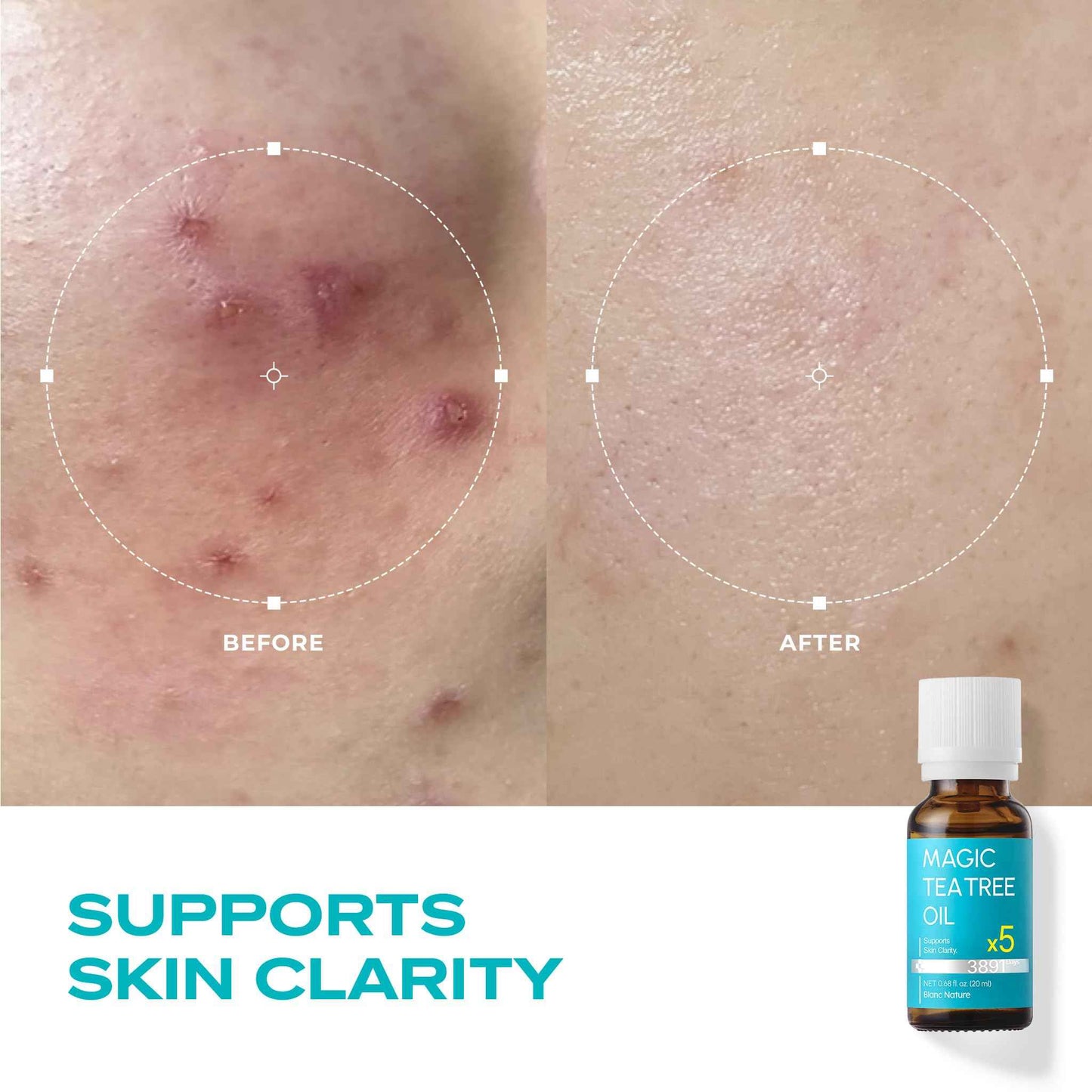 BLANC NATURE – Magic Tea Tree Oil for Face, Clarifying Facial Oil for Oily & Sensitive Skin, Lightweight Daily Care with Tea Tree, Skin-Balancing Vegan Korean Skincare, 0.7 fl oz