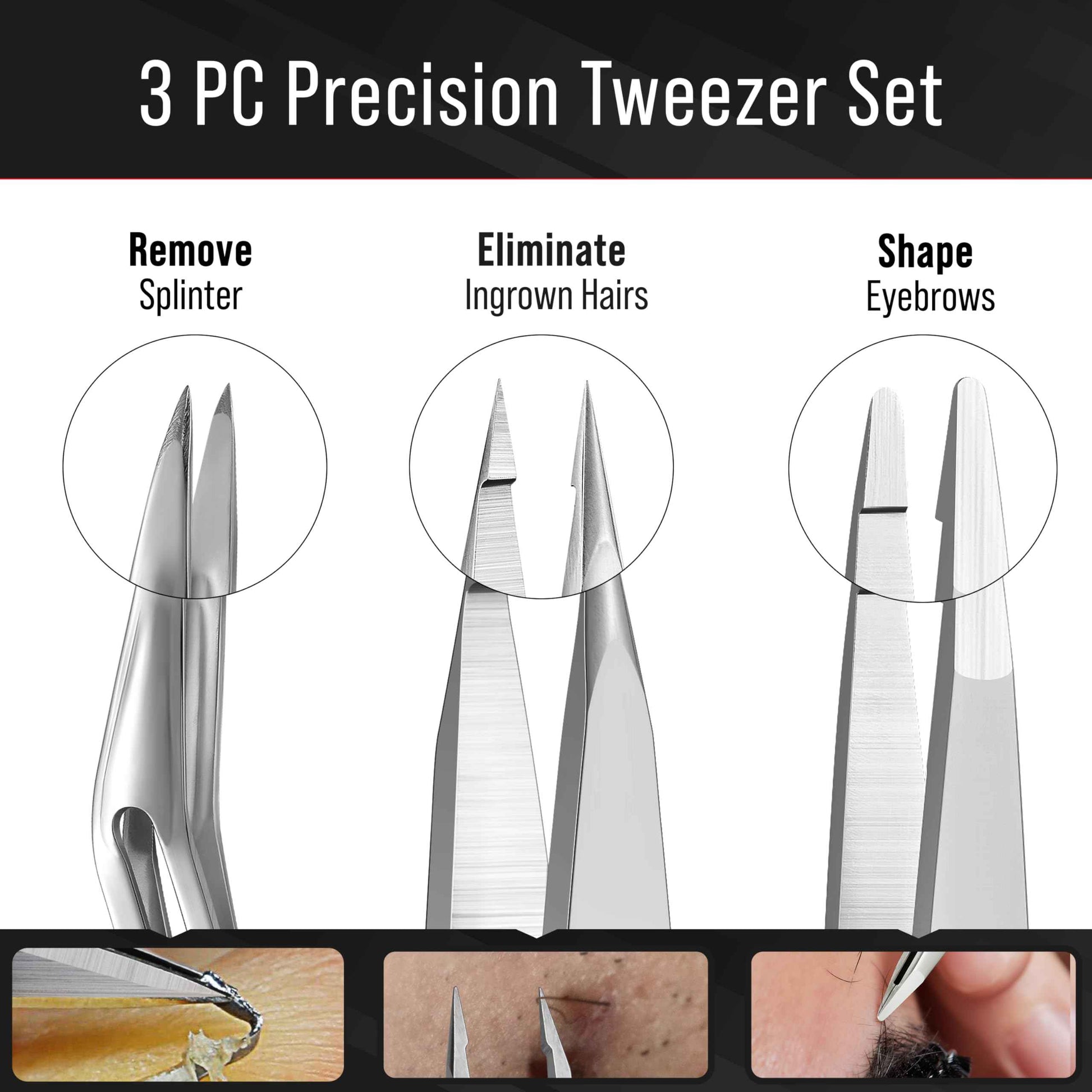 DUROX 3-Piece Tweezer Set — 1.Pointed Ingrown Hair Tweezers, 2.Fine-Tip Splinter Tweezers, 3.Safety Round Tip for Facial & Chin Hair Removal. Made of stainless steel. Protective pouch for safe storage