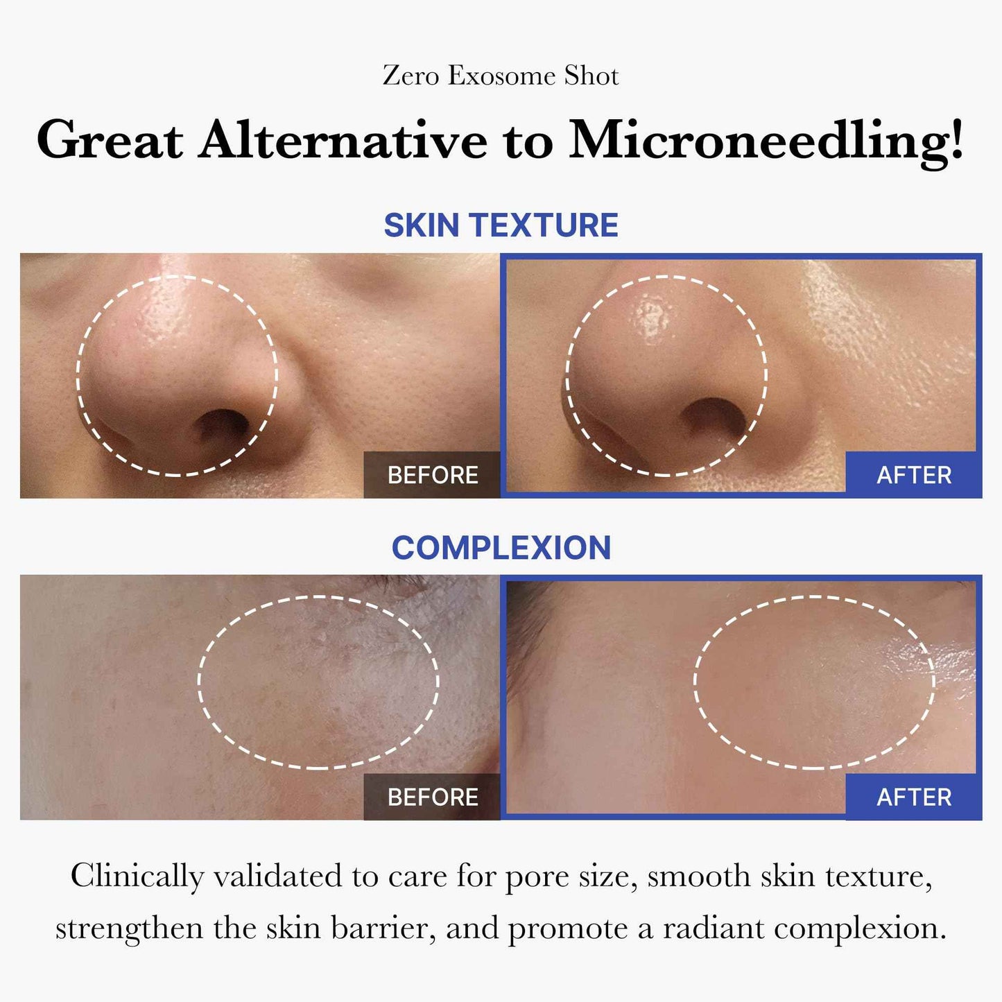 medicube Flawless Skin: Deep Vitamin C Golden Capsule Face Moisturizer and Zero Exosome Shot 7,500 PPM Spicule Facial Serum