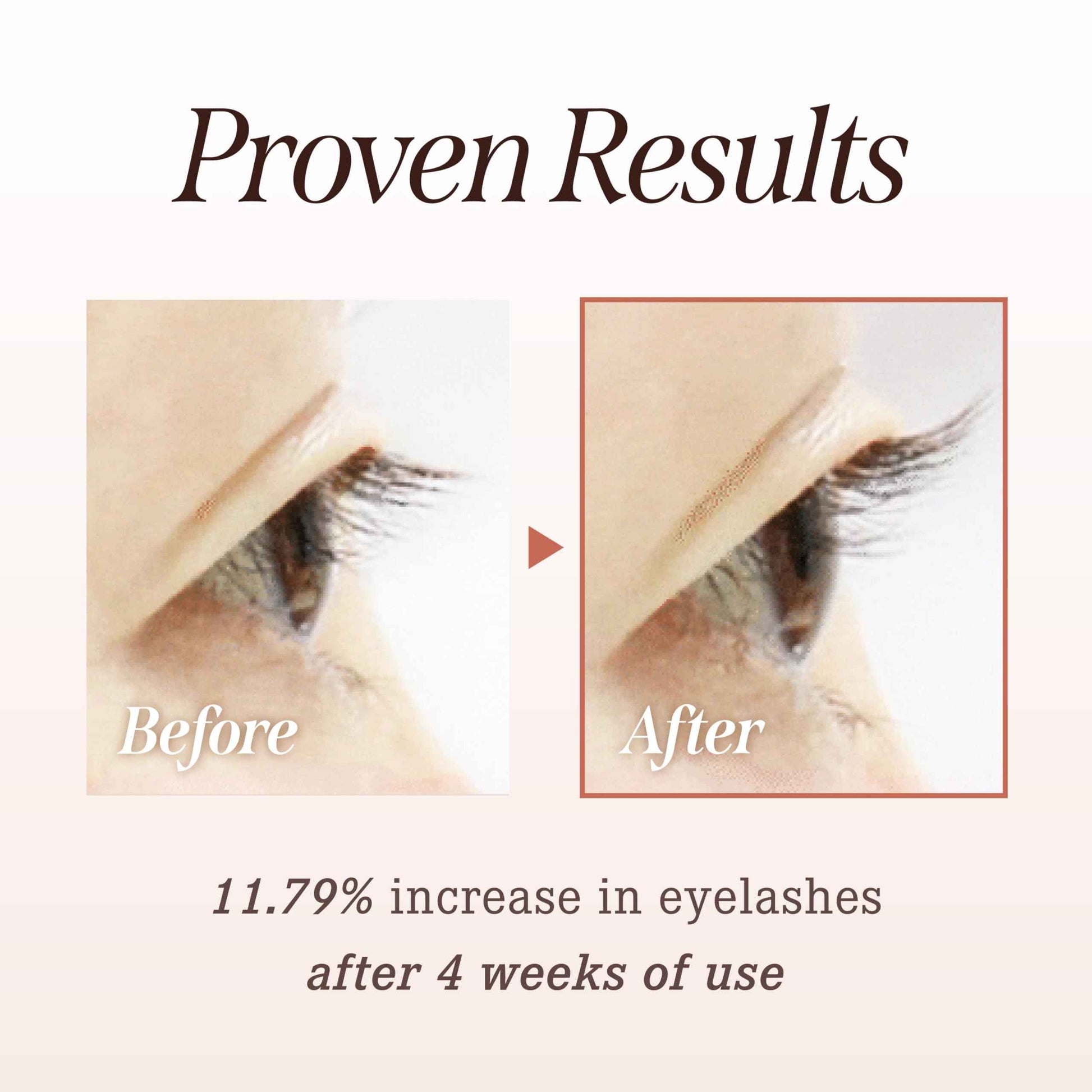 DEARDAHLIA Dream Lash Dual Serum, 9mL - Premium Eyelash Enhancer for Longer, Fuller, Thicker Lashes. Non-Irritating Formula, Hydrating & Healthy-Looking, Easy Application