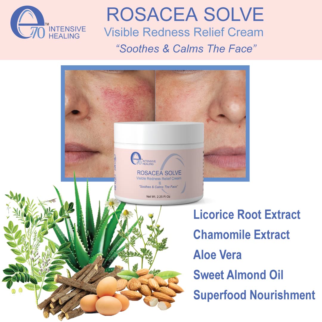 e70 Rosacea Solve - Redness Relief Cream - Face Moisturizer For Rosacea & Acne Prone Skin - Skin Care With Organic Ingredients, Almond Oil, Licorice and Chamomile Extracts - No Parabens (Pack of 2)