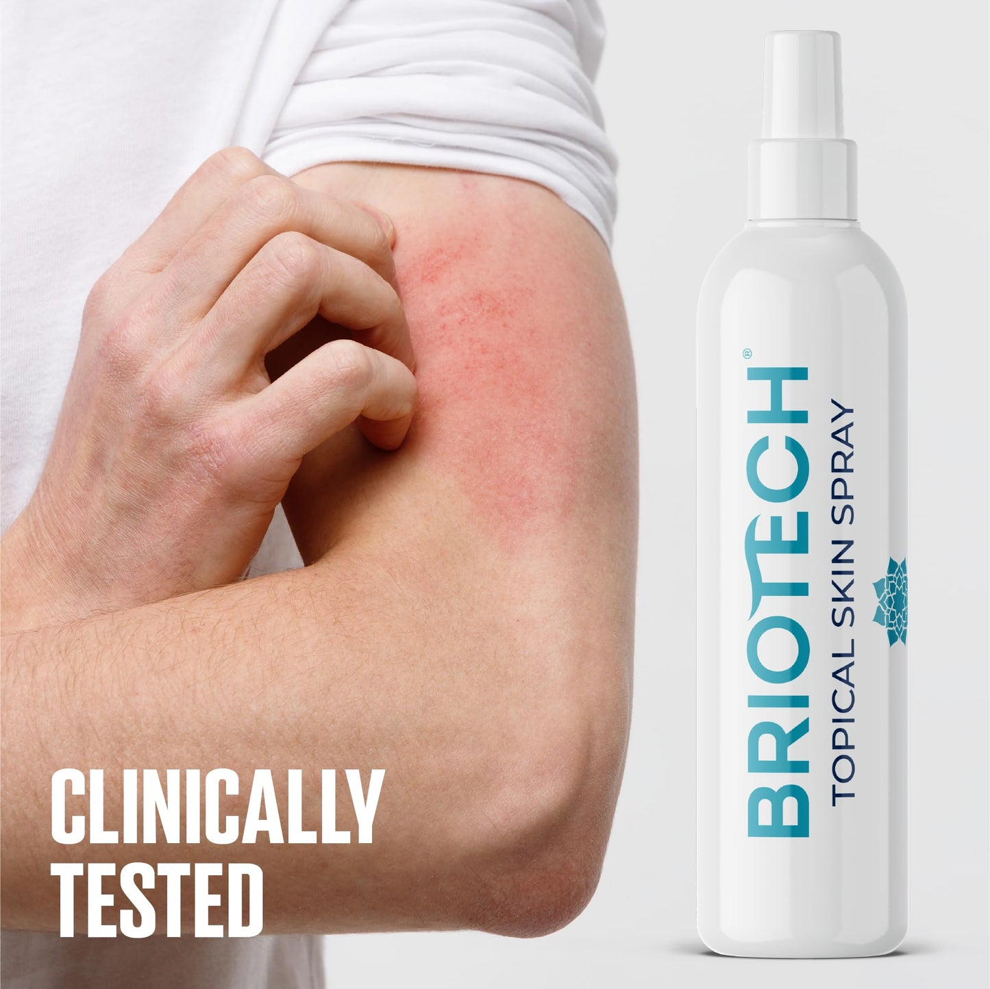 BRIOTECH Hypochlorous Acid Spray, Topical Skin Face & Body Mist, Support Irritations, Soothe Redness, Dry Skin & Scalp, Athletic Itch, Packaging May Vary