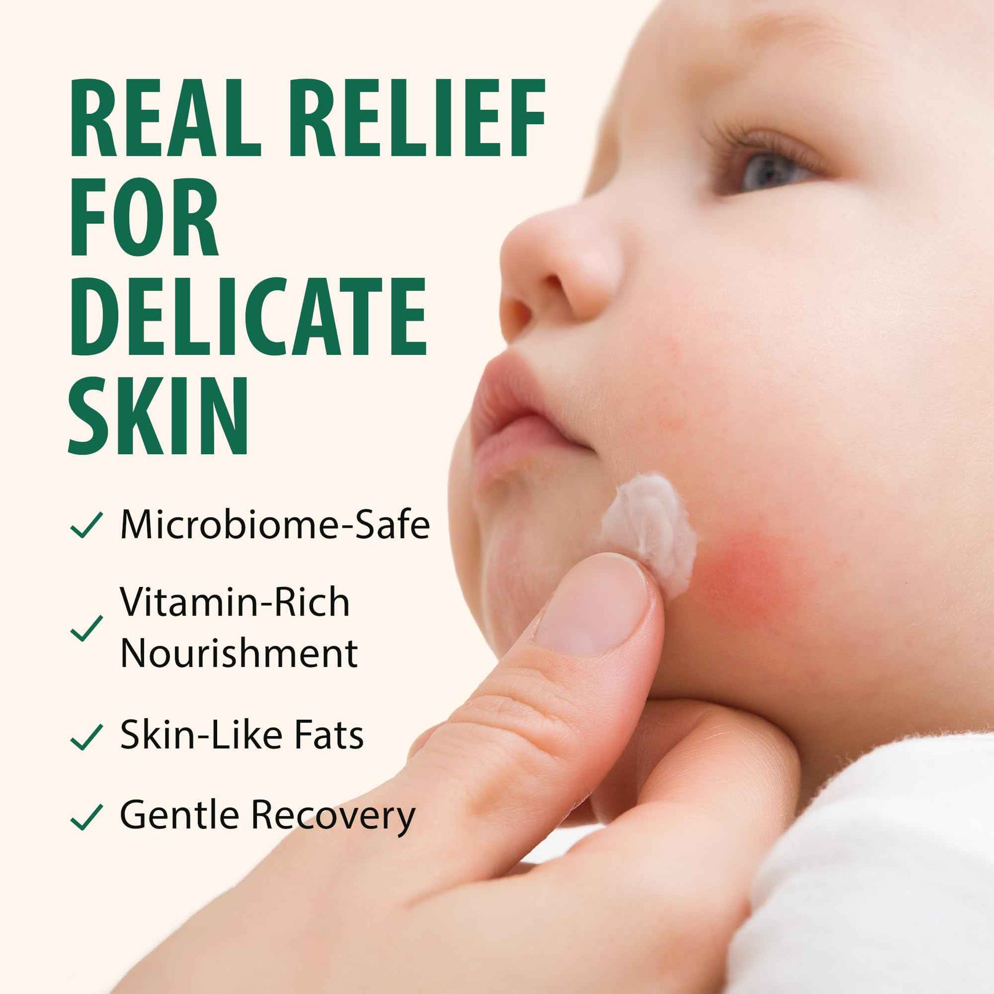 DERMOIA Grass Fed Whipped Beef Tallow for Skin with Manuka Honey - Silky Smooth, Fast Absorbing Tallow & Honey Balm - Ideal for Kids & Eczema Prone Area - Whipped Moisturizer for Dry & Sensitive Skin