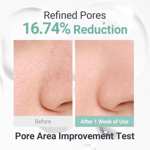 NEAF NEAF Soothing Calm Toner Pad, Daily Gentle Exfoliating & Hydrating Facial Pads for Intense Soothing Care, Heartleaf Extract and CICA for Sensitive Skin Safe, Korean Skincare (60 Pads)