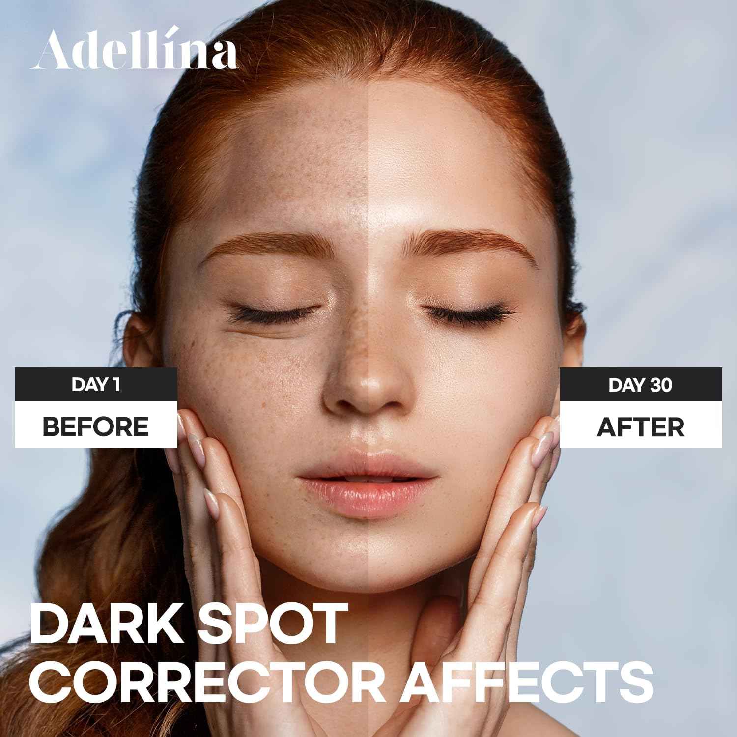 Dark Spot Remover for Face: Dark Spot Corrector for Sun Spots, Age Spots & Uneven Skin Tone - Vitamin C, Alpha Arbutin & Niacinamide for Even Skin Tone (1 Fl Oz)