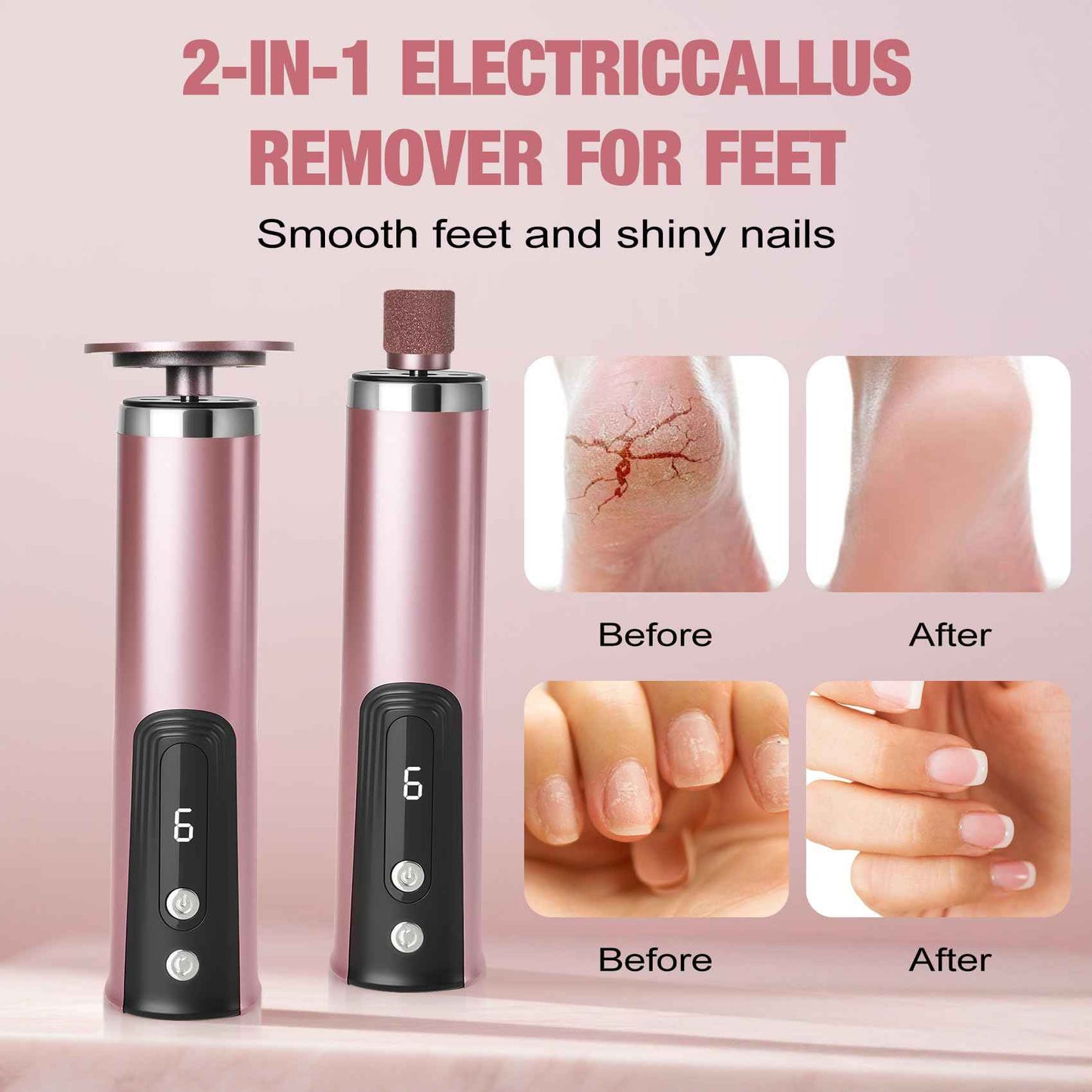 Callus Remover for feet, Electric Foot Callus Remover, Foot File with 6 Adjustable Speed, Foot Scrubber Scraper with 2 Grinding Heads & Sandpaper Discs, Pedicure Tools for feet with Digital Display