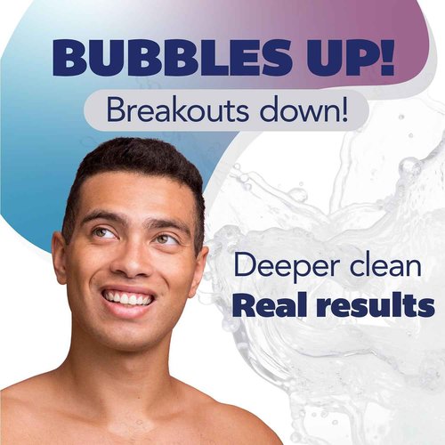 Asepxia Acne Treatment Bar Soap with Baking Soda | Face Wash, Deep Cleansing, Natural Extracts, Gentle Daily Use, 1.8% Salicylic Acid for Pimples & Blackheads, 4 Oz, 5-Pack