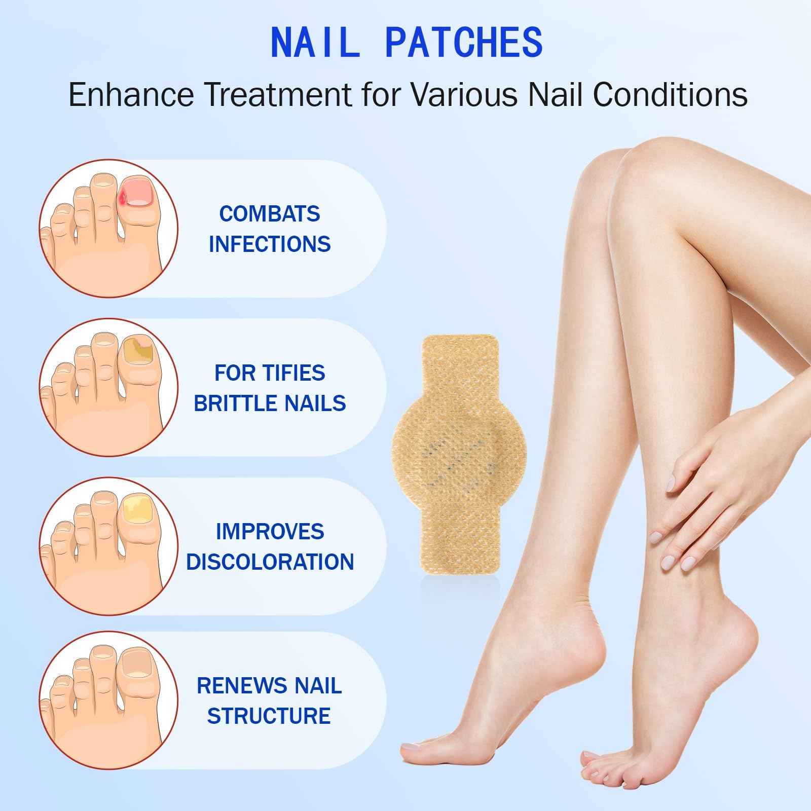 Nail Patches 42 PCS - Nail Treatment Patches Extra Strength for Damaged Nails, Nighttime Nail Patches for Women & Men, Easy to Apply
