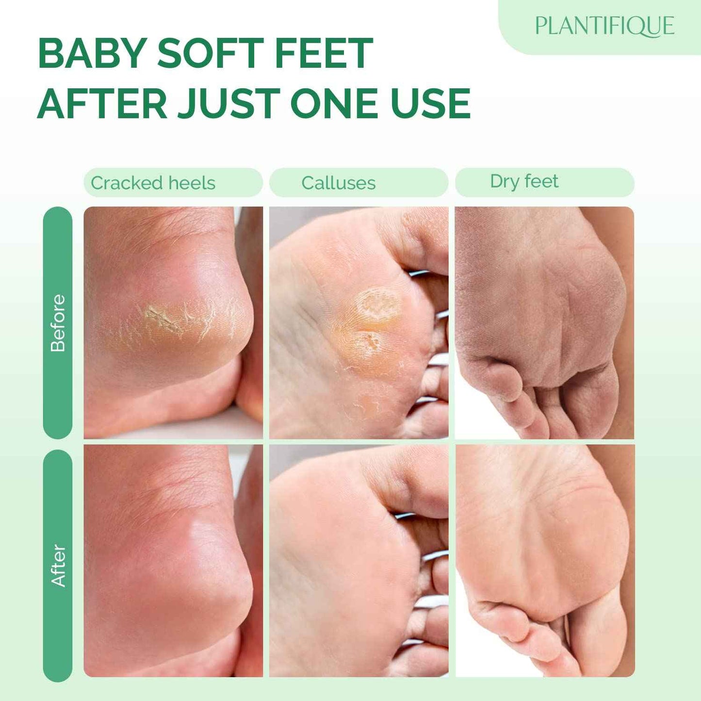 PLANTIFIQUE Foot Peel Mask with Peach 2 Pack and Hydrating Foot Mask for Dry & Cracked Feet