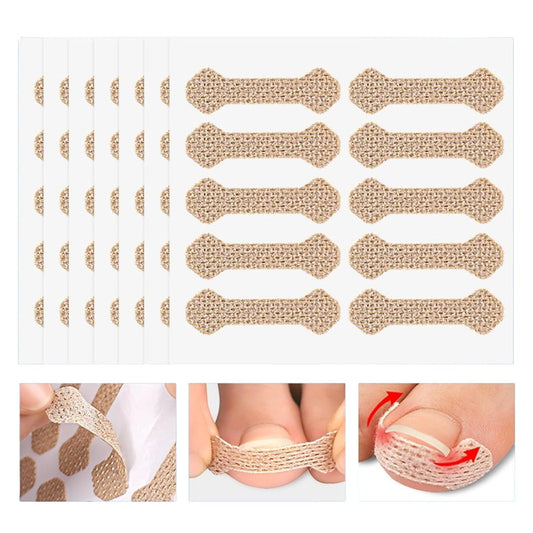 Ingrown Toenail Treatment, 60Pcs Breathable Ingrown Toenail Strips,Painless Ingrown Toenail Tool, Professional Pedicure for Ingrown Toenail, Brown