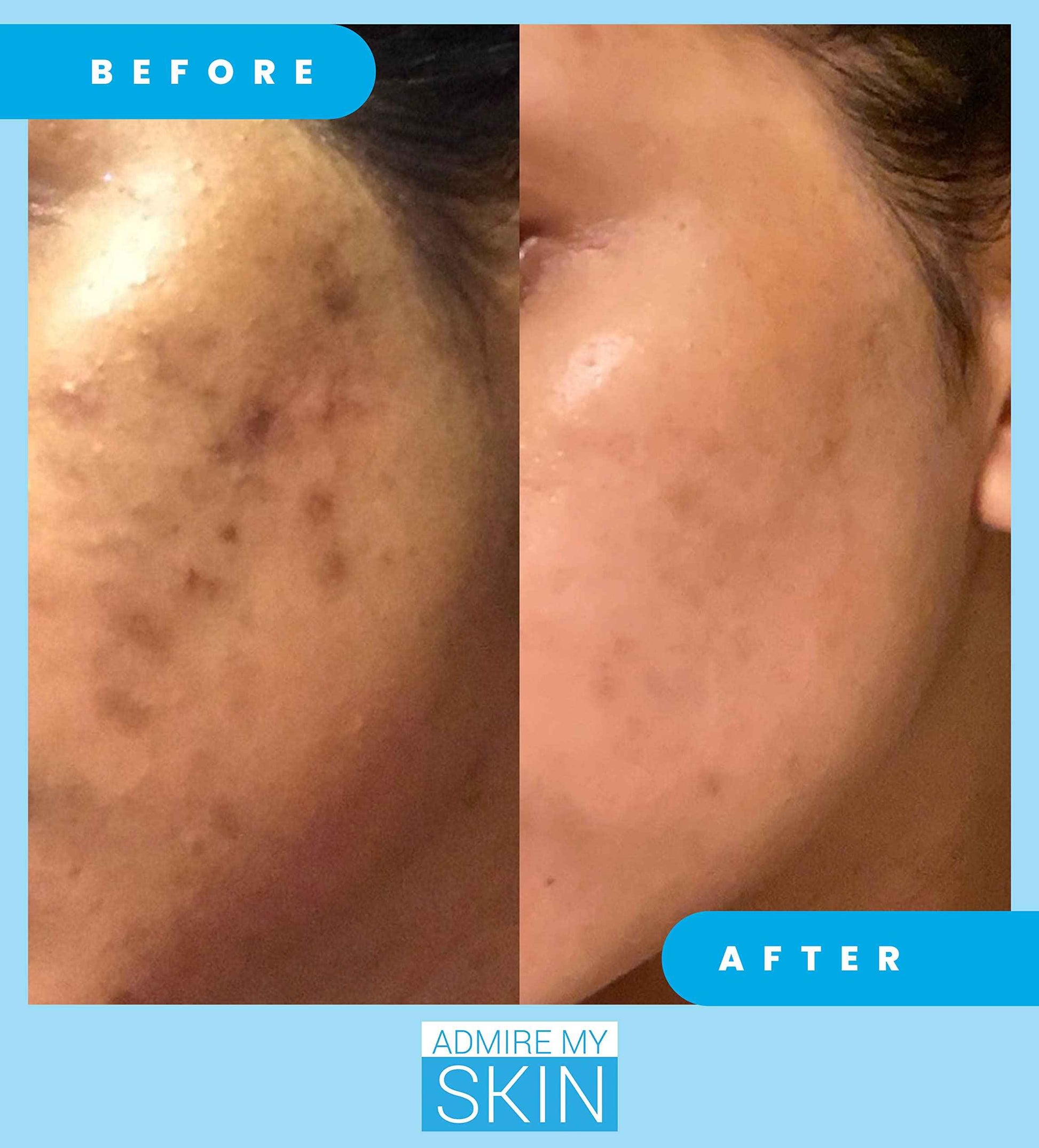 Admire My Skin Dark Spot Corrector Serum + Retinoid Cream Set