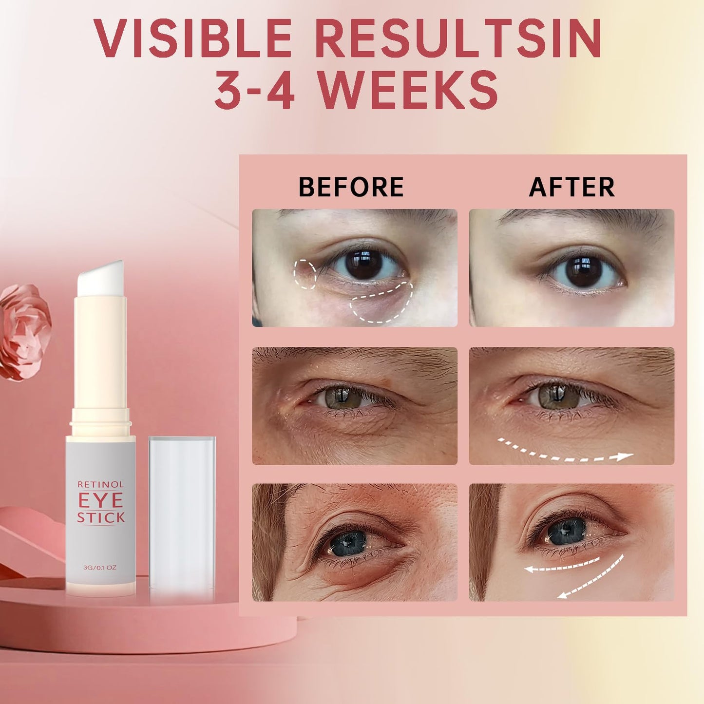 1Pcs Retinol Eye Stick, Retinol Under Eye Cream for Puffiness and Dark Circles, Hydrating Eye Cream Anti Aging for Enhanced Under Eye Nourishment.