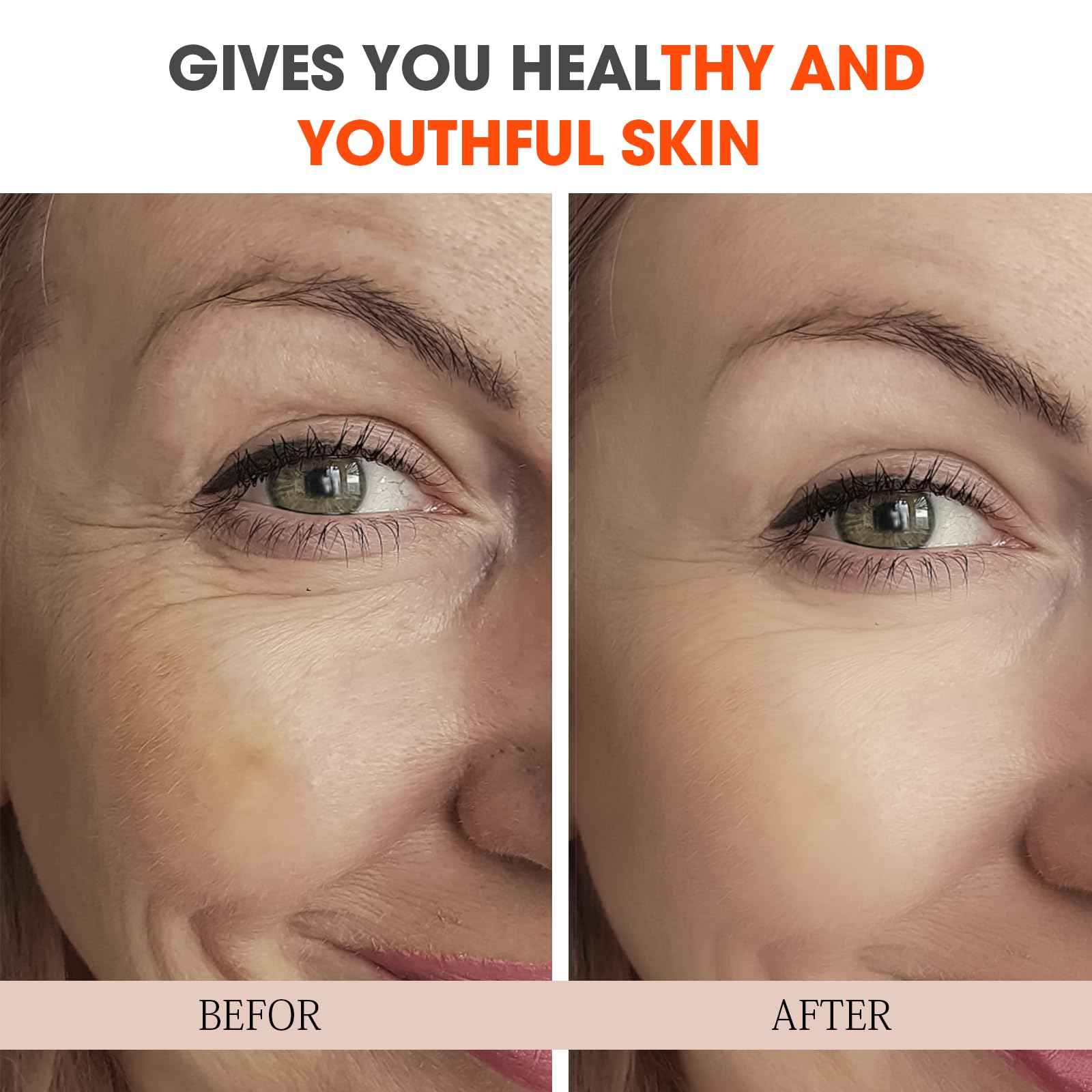 Super Vitamin C Serum for Women over 70, All-In-One Total Package Face Serum for Mature Skin, Hydrating, Lifting, Anti-Aging Reduce Wrinkles Age Spots