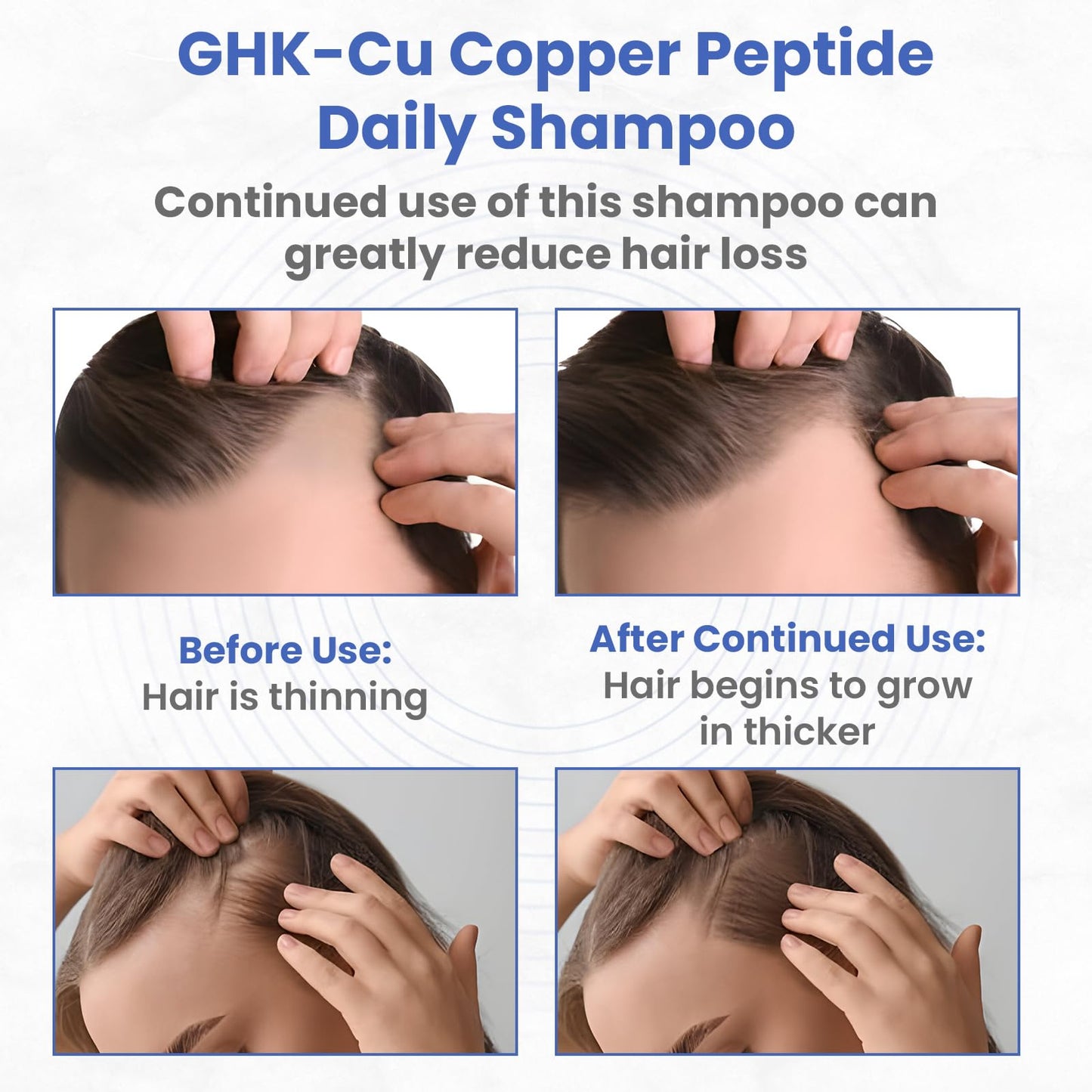 GHK-Cu Copper Peptide Shampoo - Anti Hair Loss Shampoo - Promotes New Hair Growth