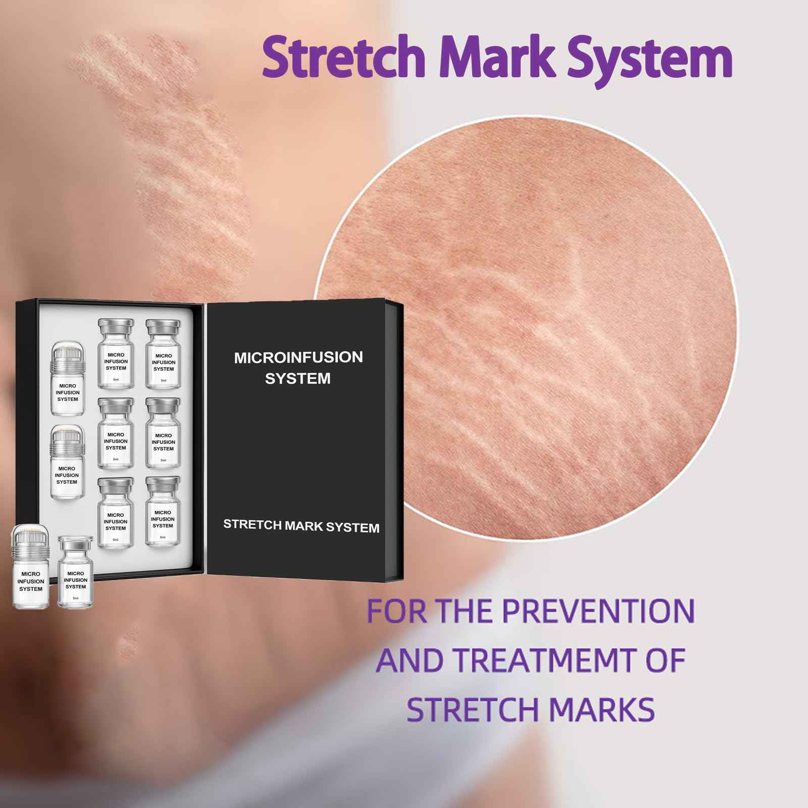 Stretch Mark System, Infused with Collagen and Elastin Support – Hydrating & Nourishing Formula for Smoother Looking Skin (1)