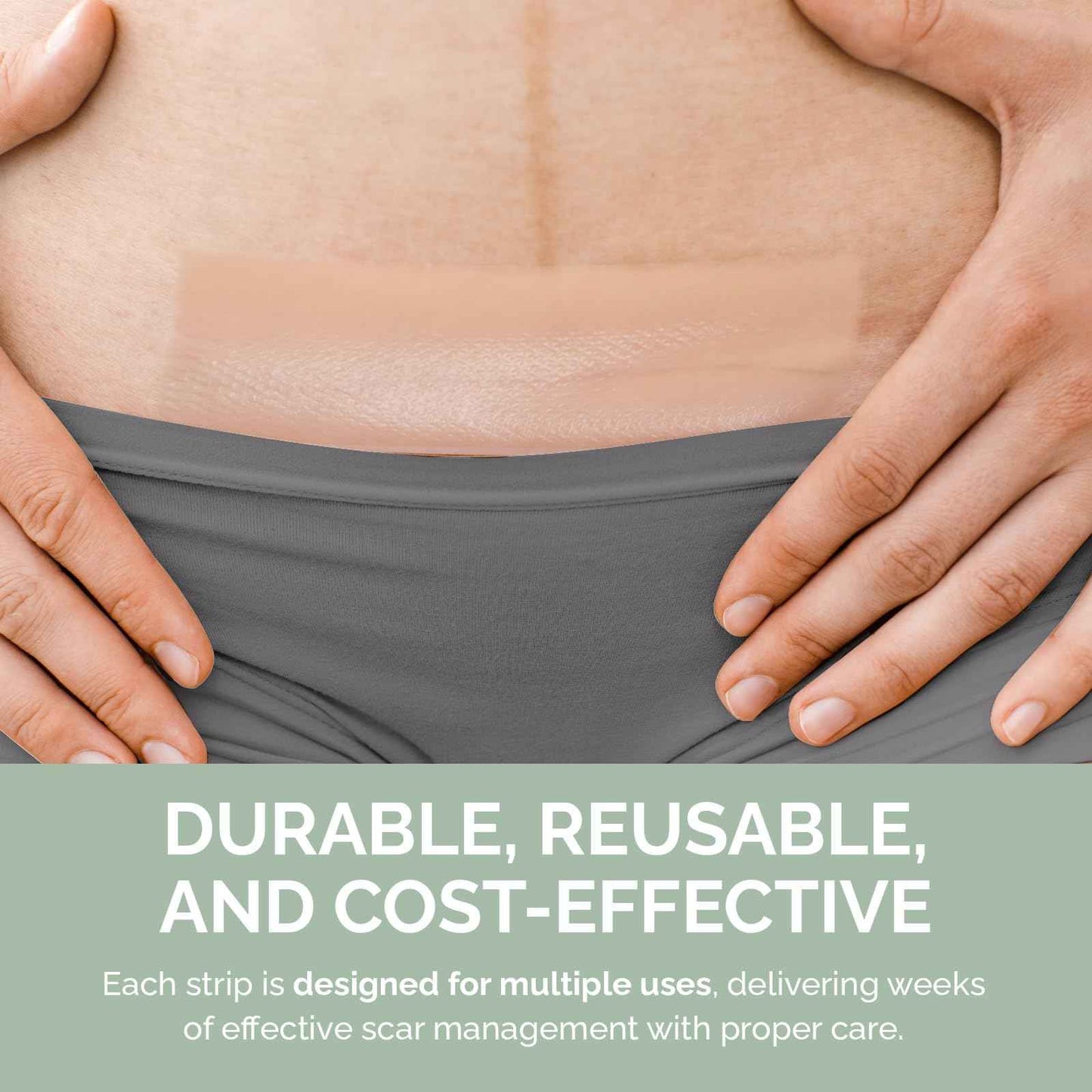 RecoverEase Silicone Scar Strips – Reusable Medical Grade Silicone & Individually Wrapped Scar Sheets for Mastectomy & C-Section, Scar Treatment Tape for Tummy Tuck, Keloid, Surgical, Burns - 12 Pack