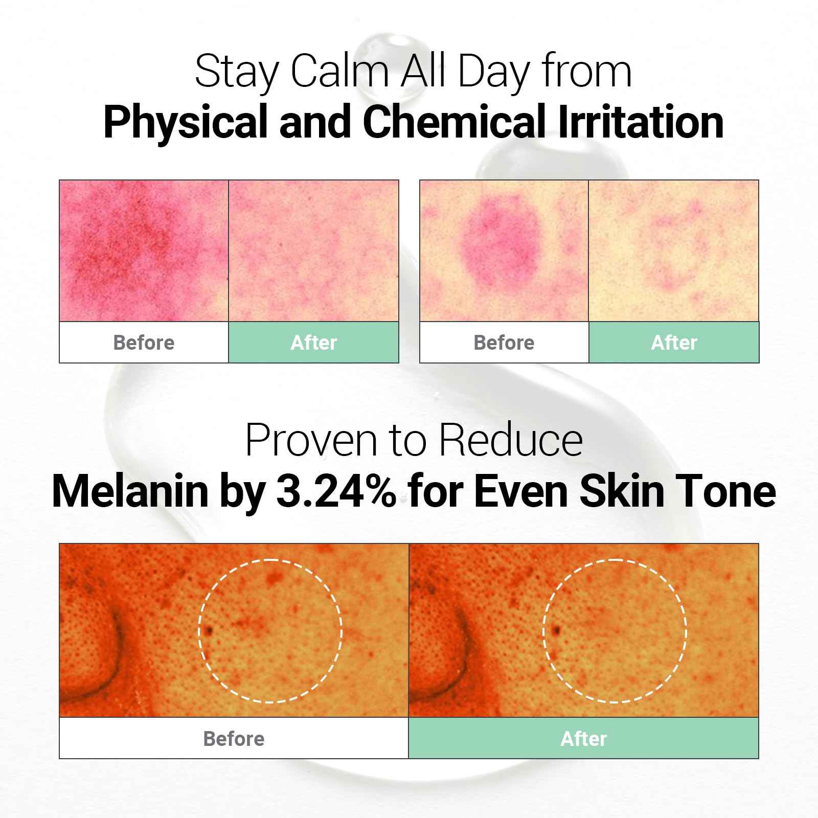 NEAF NEAF Soothing Calm Ampoule with Niacinamide, Spot Care Hyaluronic Acid, Non-Greasy, CICA Healing and Gentle Formula (30ml /1.01 oz) Radiant Serum, Korean Skincare