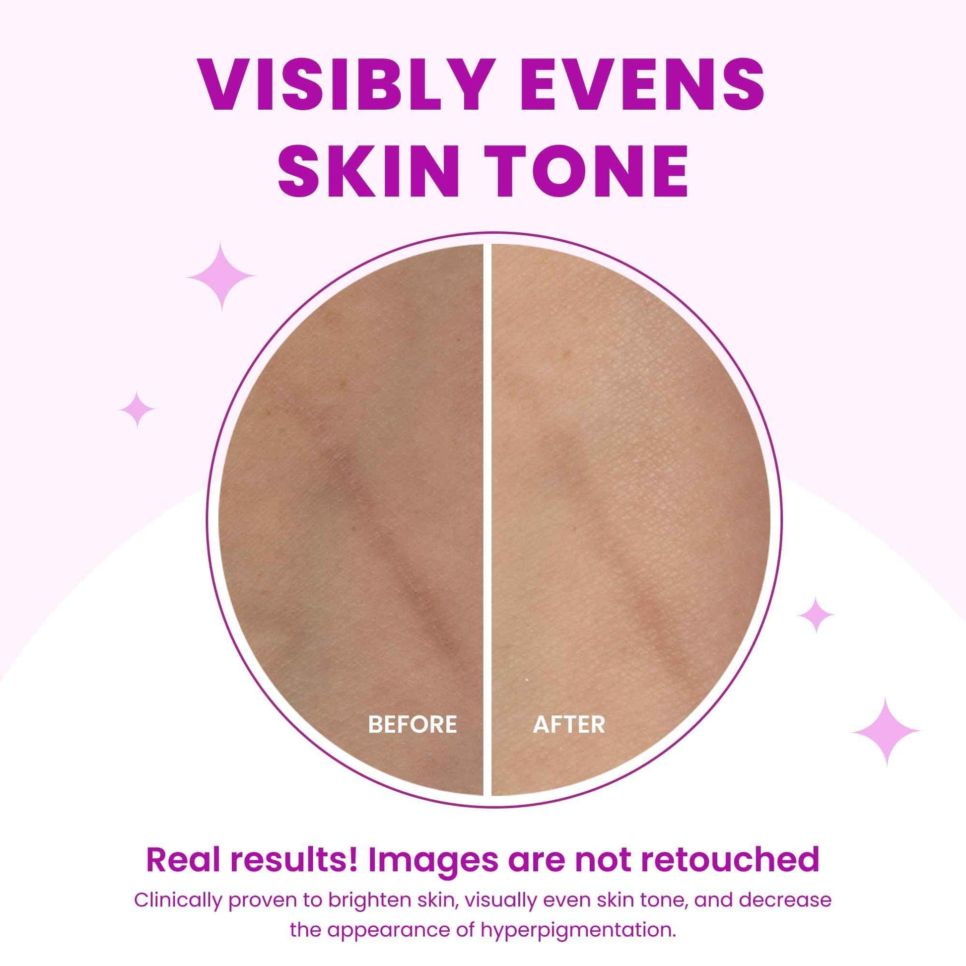 Lume Acidified Body Wash & Flushable Deodorant Wipes - 24 Hour Odor Control - Hydrating Wash - Without SLS or Parabens - OB/GYN Developed - 8.5 Ounce (Unscented) 15 Count Wipes (Cool Cucumber)