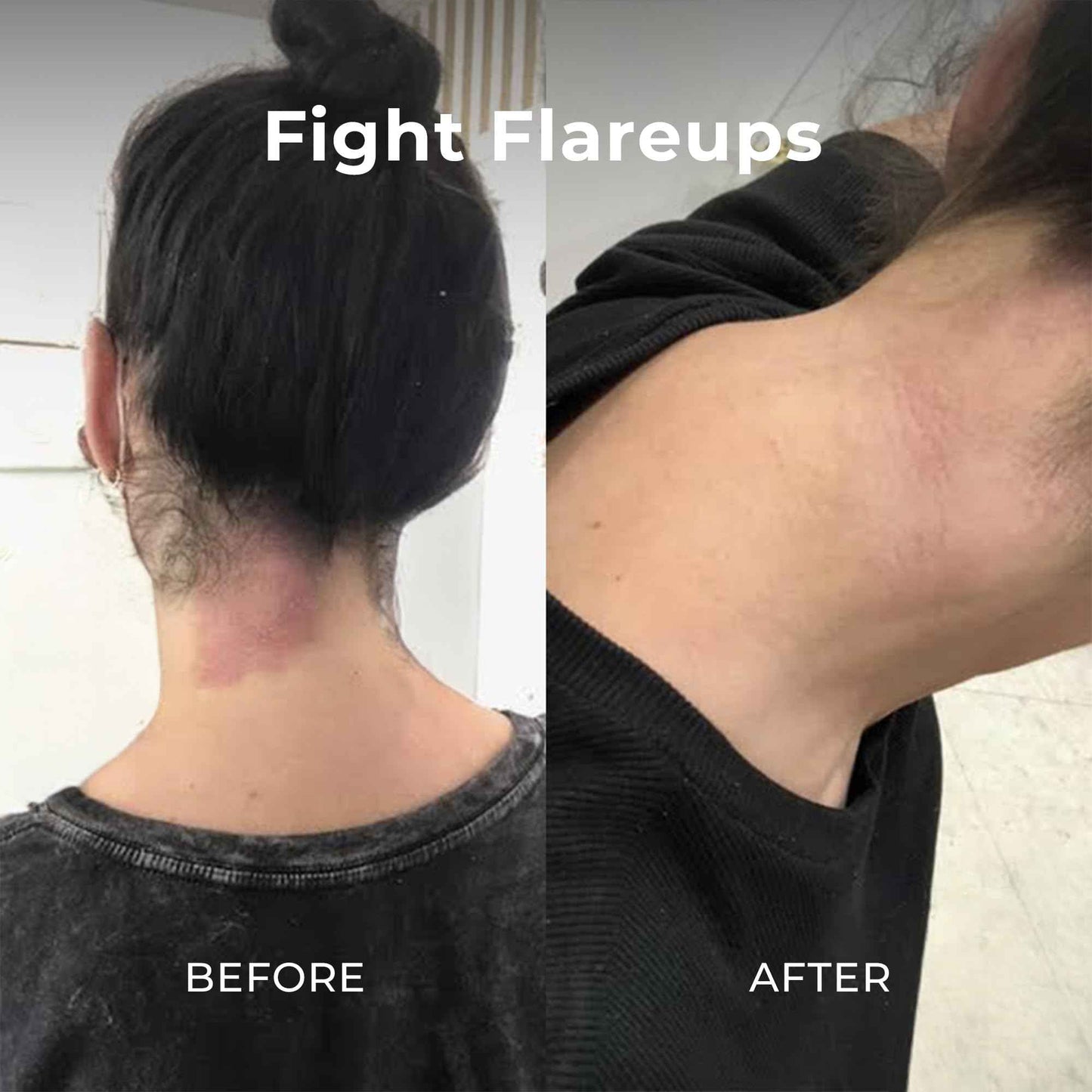 Miami Beach Bum, Bum + Body Cream Daily Moisturizer For Total Skin Health, Body Acne Treatment, Razor Bumps, Keratosis Pilaris, Ingrown Hairs, Sunburns, Blemishes, Orange 6.7 Fl OZ (Pack of 1)