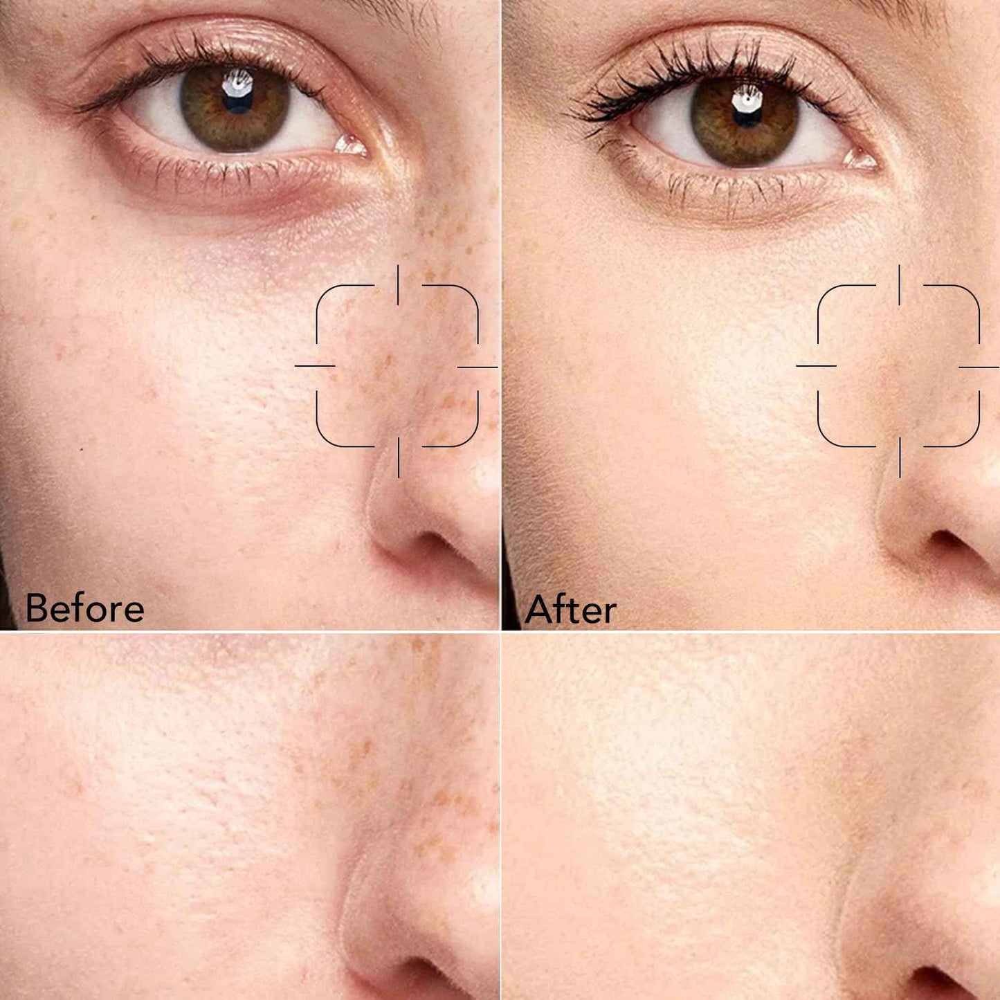 Skin Care Kit for Women, Hydrating Skincare Set Niacinamide+Vitamin C, Daily Routine 5 In 1 W/Facial Cleanser, Toner, Serum, Cream, and Mask, Fragrance-Free, Suit for All Skin Type