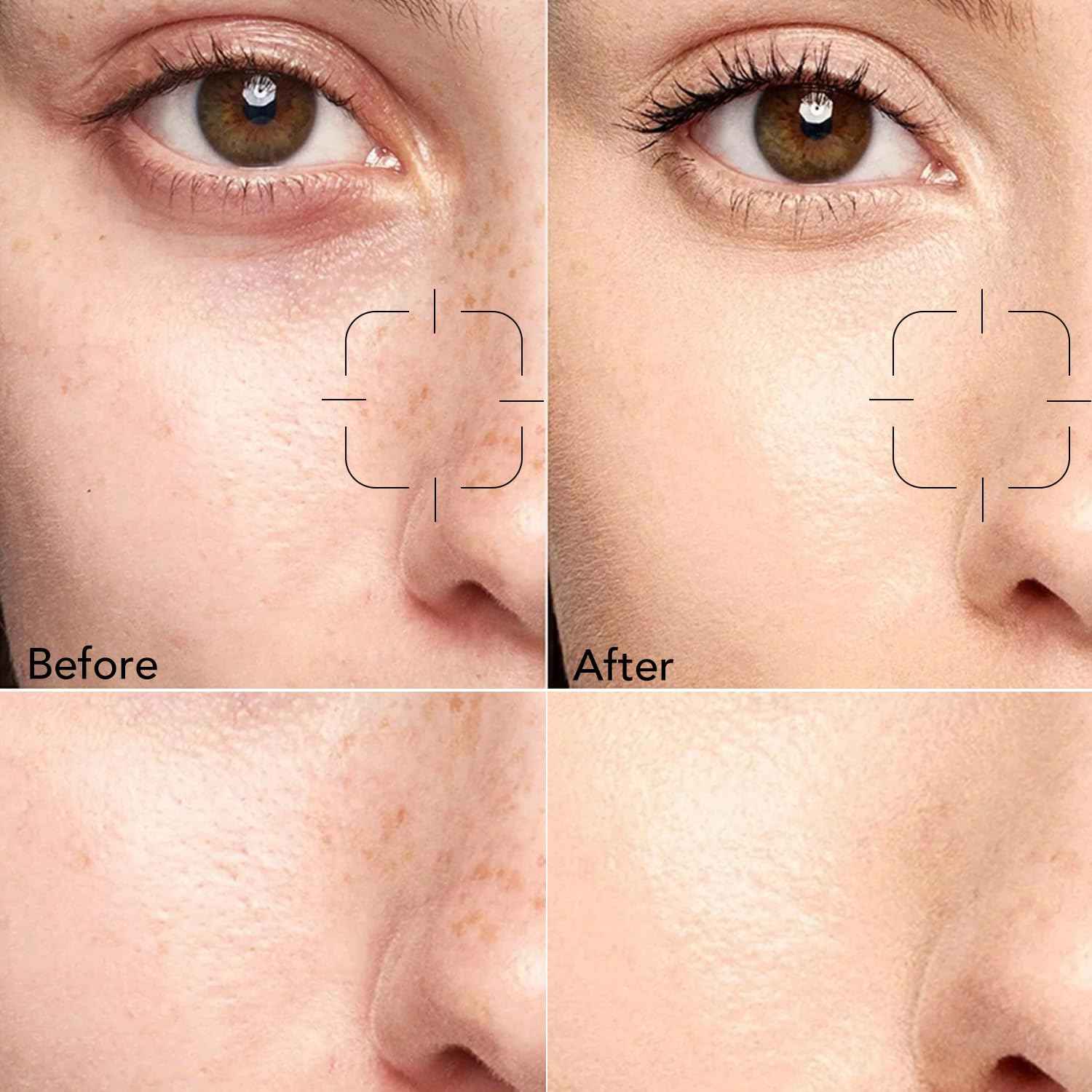 Skin Care Kit for Women, Hydrating Skincare Set Niacinamide+Vitamin C, Daily Routine 5 In 1 W/Facial Cleanser, Toner, Serum, Cream, and Mask, Fragrance-Free, Suit for All Skin Type