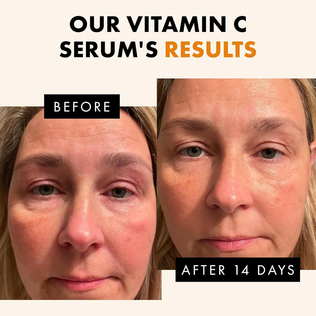 Eclat Skincare Vitamin C Face Serum - Skin Care for Dark Spots, Vitamin C Serum with Hyaluronic Acid, Ferulic Acid, & Vit E - Anti Aging and Skin Brightening, Pure Vit C Facial Care - 30 ml