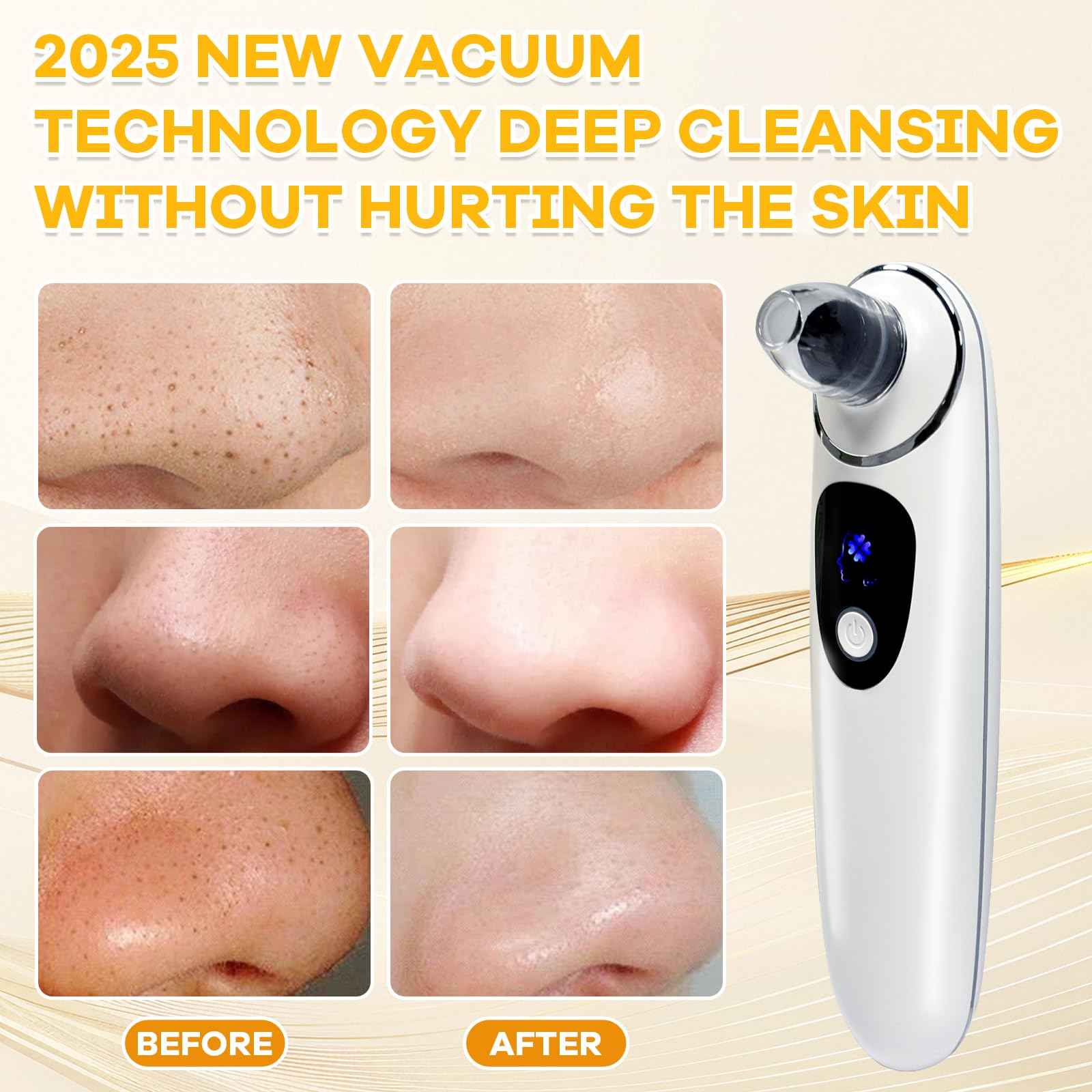 2025 Pore Vacuum with Camerafor, USB Rechargeable Blackhead Remover Vacuum,3 Levels Adjustable Pore Vacuum Blackhead Remover, 6 Suction Heads,Face Vacuum Pore Cleanser for Women & Men